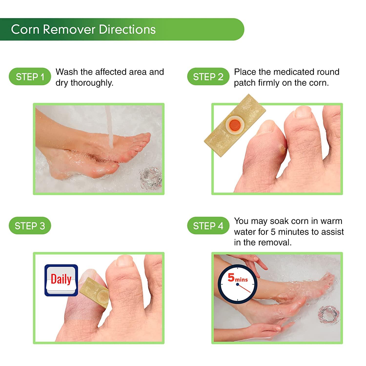 12 Pieces=2 Bags Foot Corn Callus Remover Patch Remove Spurs Hard