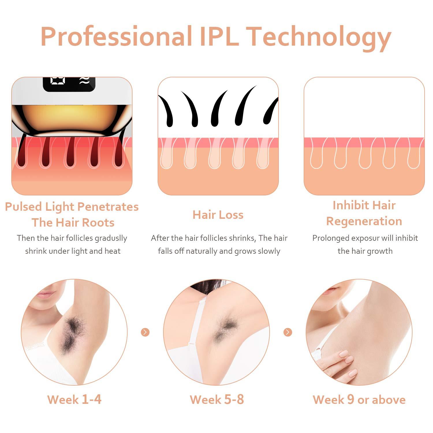 At-Home IPL Hair Removal for Women and Men,Laser Hair Removal