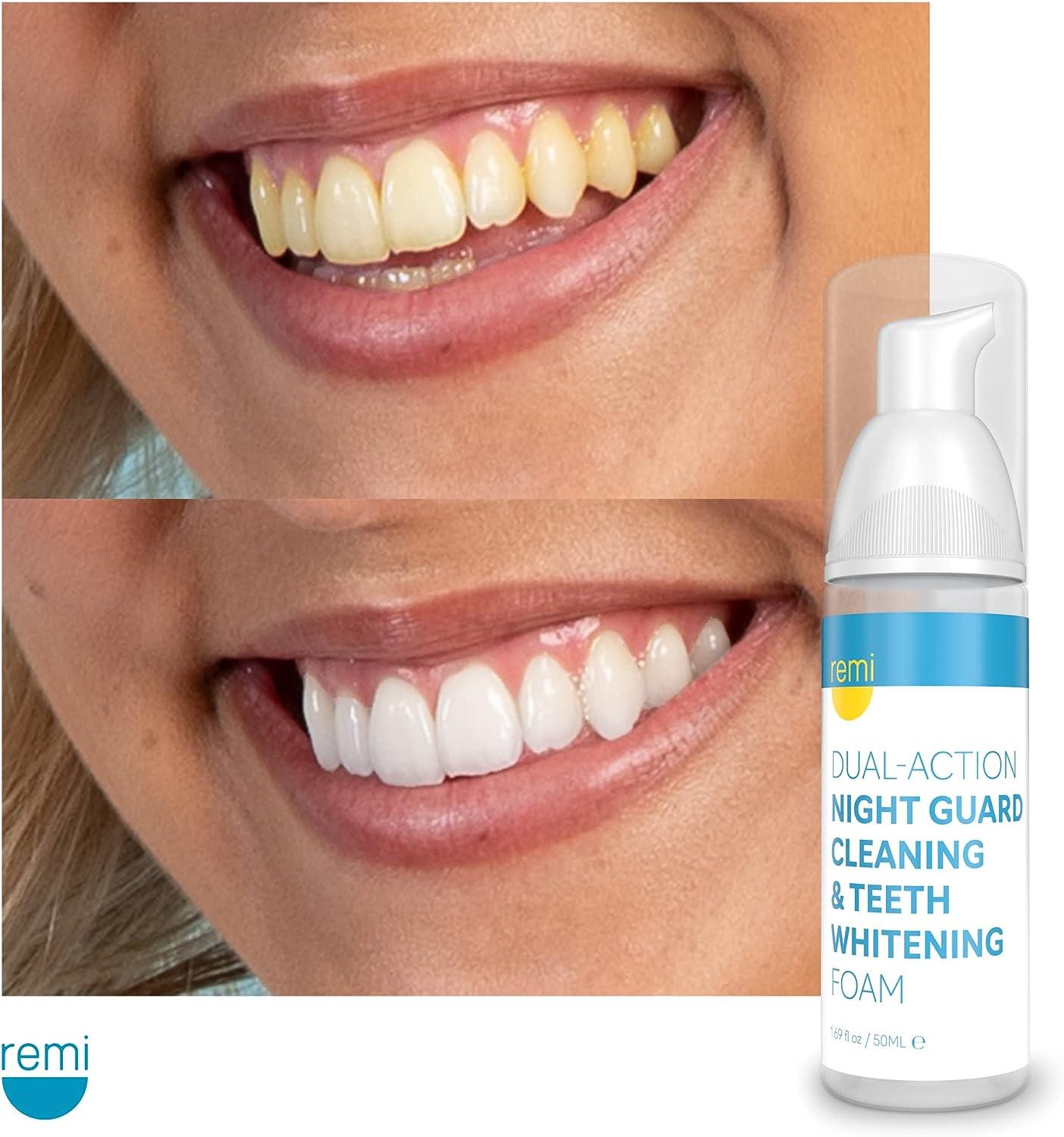 Whitening Mouth Guards - Teeth Whitening