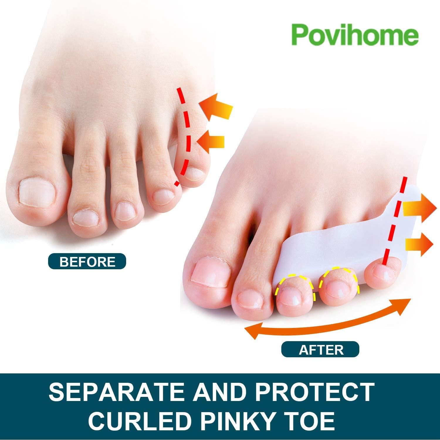 Povihome 10 Pack Clear Toe Spacers, Big Toe Separator (1st/2nd Toe