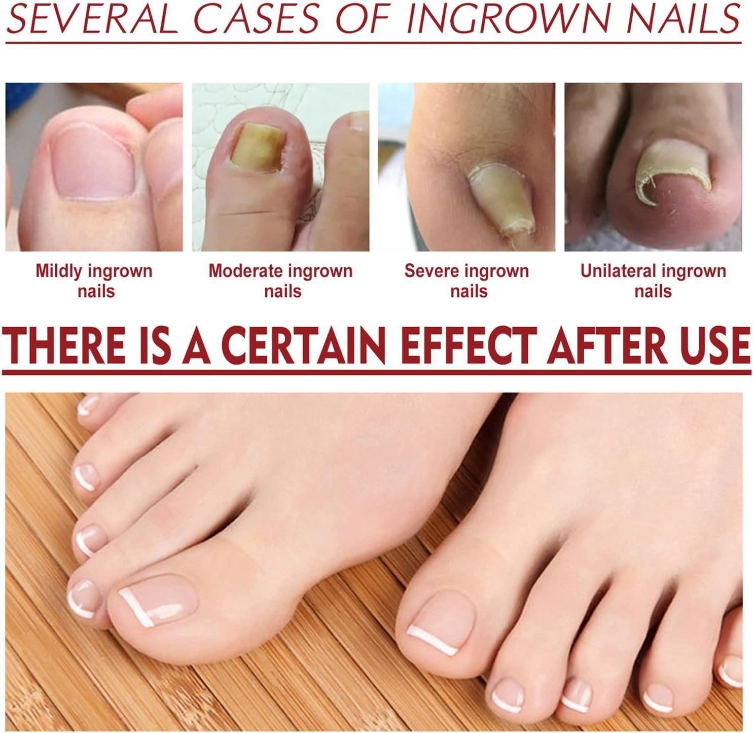Foot Clinic - Thick Nails