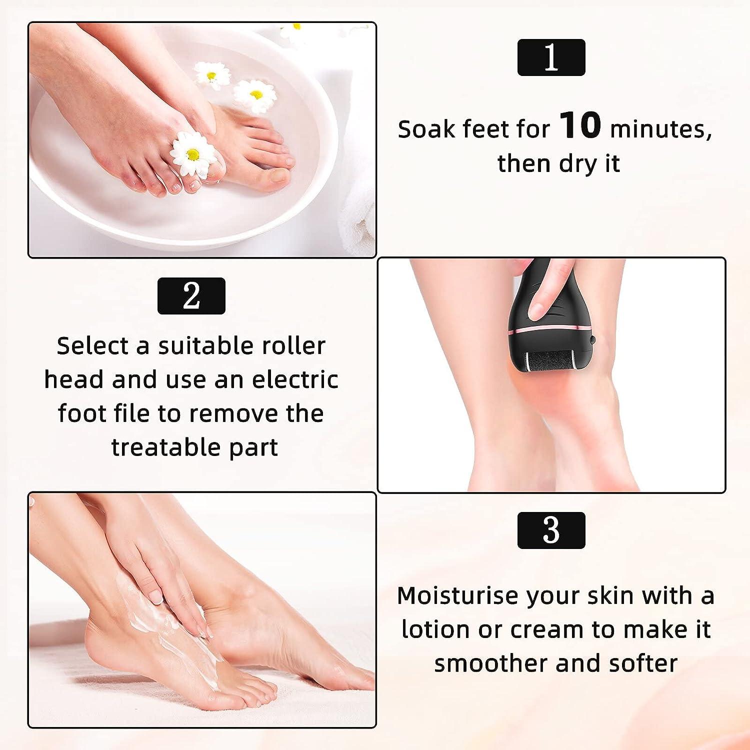 Electric Foot Scrubber for Dead Skin, For Personal