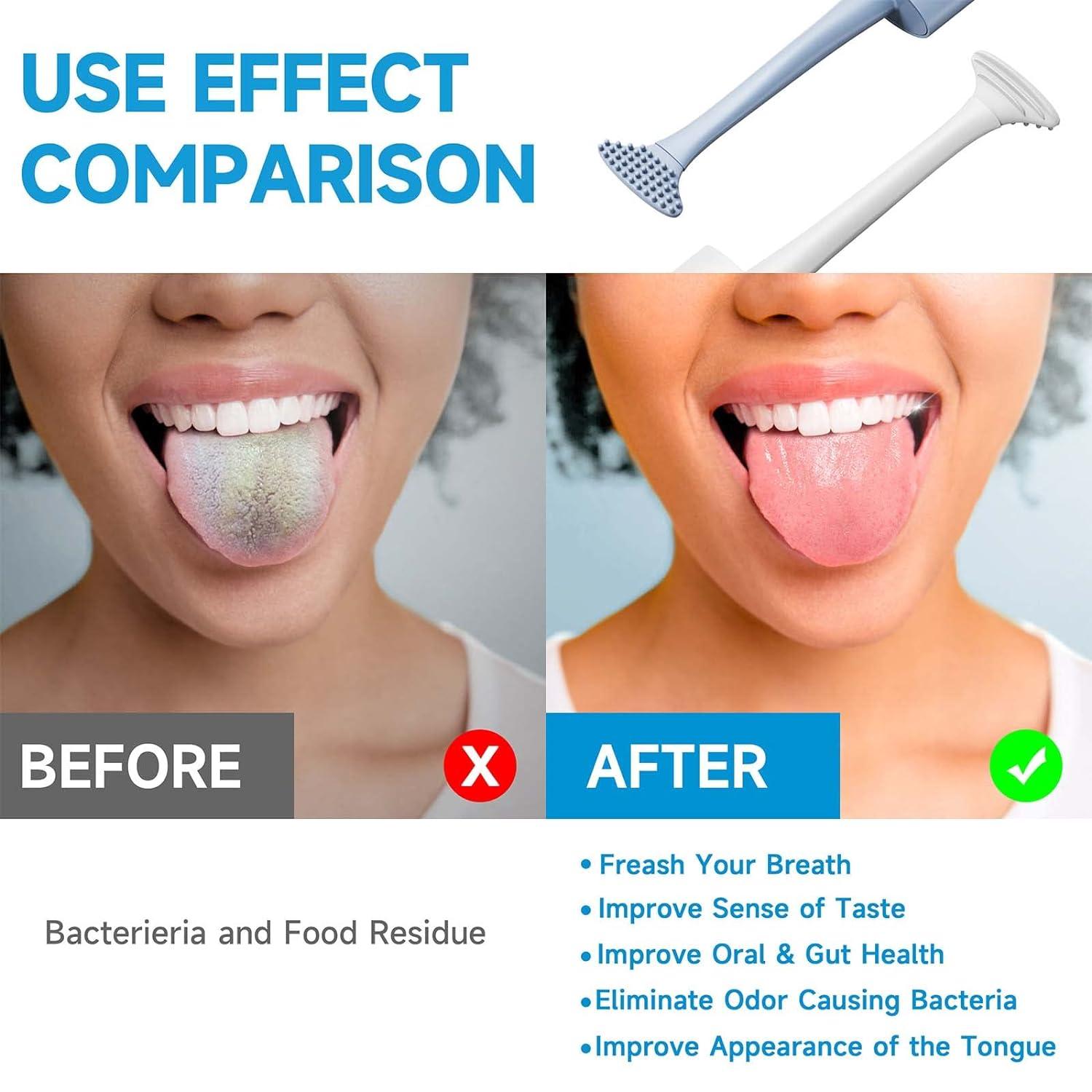  Tongue Scraper, Tongue Cleaning Brush Care, Plastic Tongue  Scraper Travel Portable Freshen Breath Tongue Brush Cleaner for Oral Care :  Health & Household