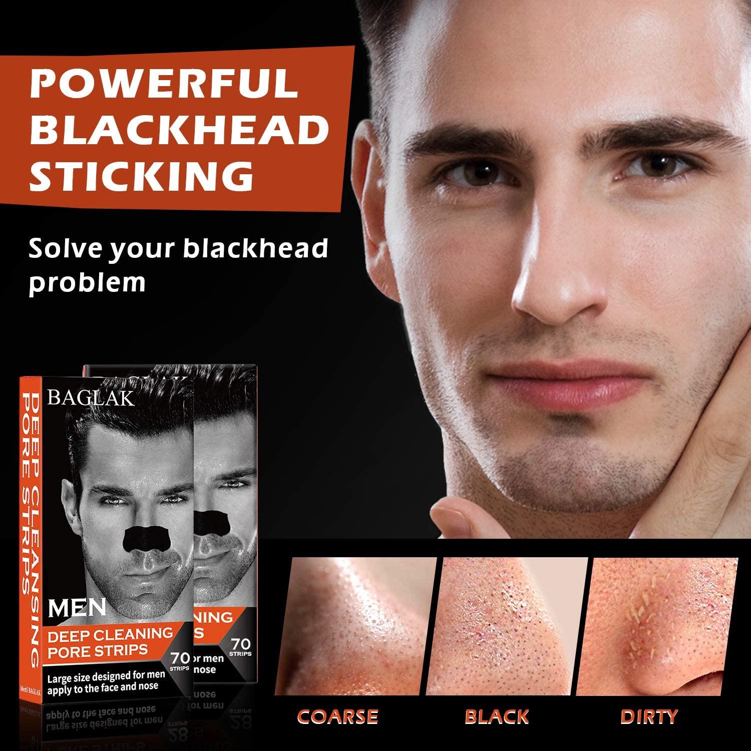 blackheads on face men
