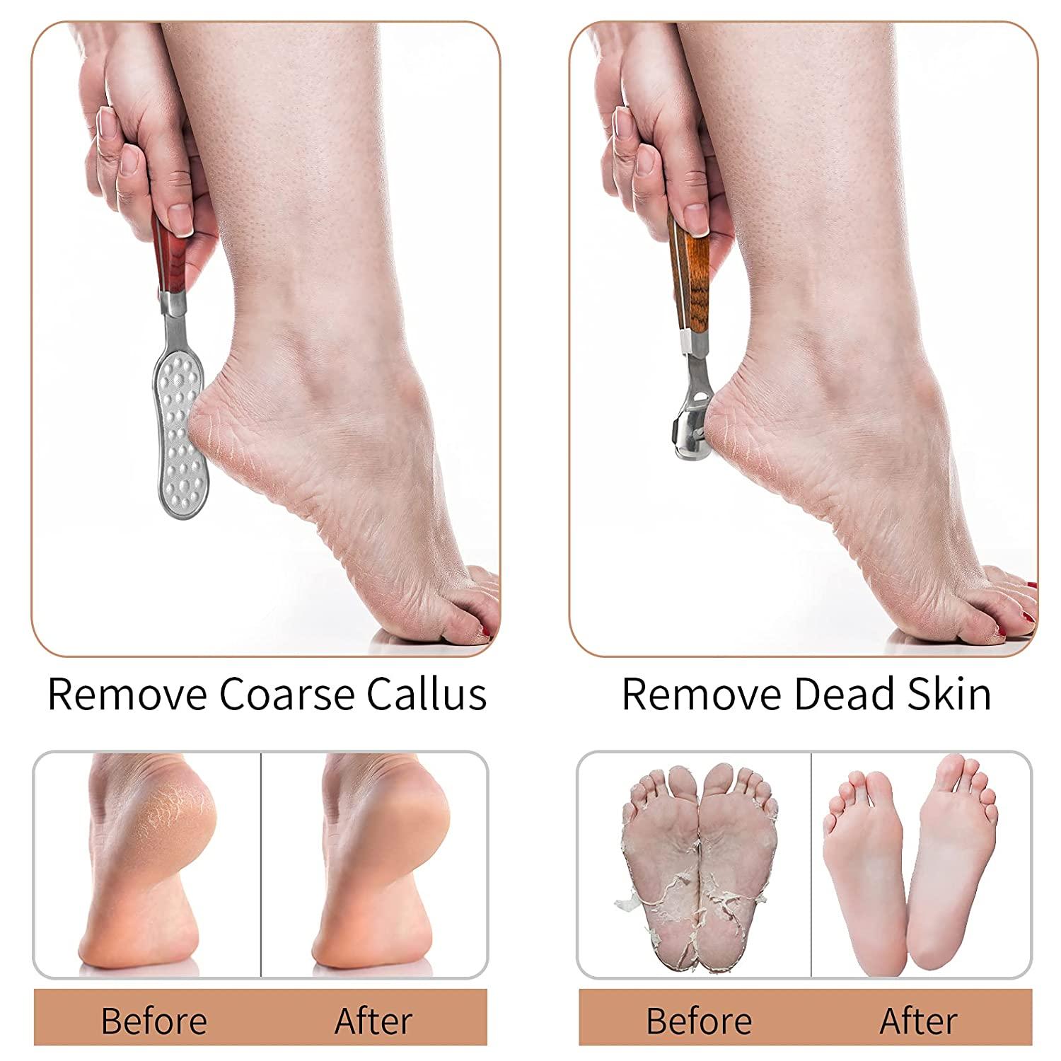 Callus Remover for Feet: Electric Foot Scrubber JTLMEEN Waterproof