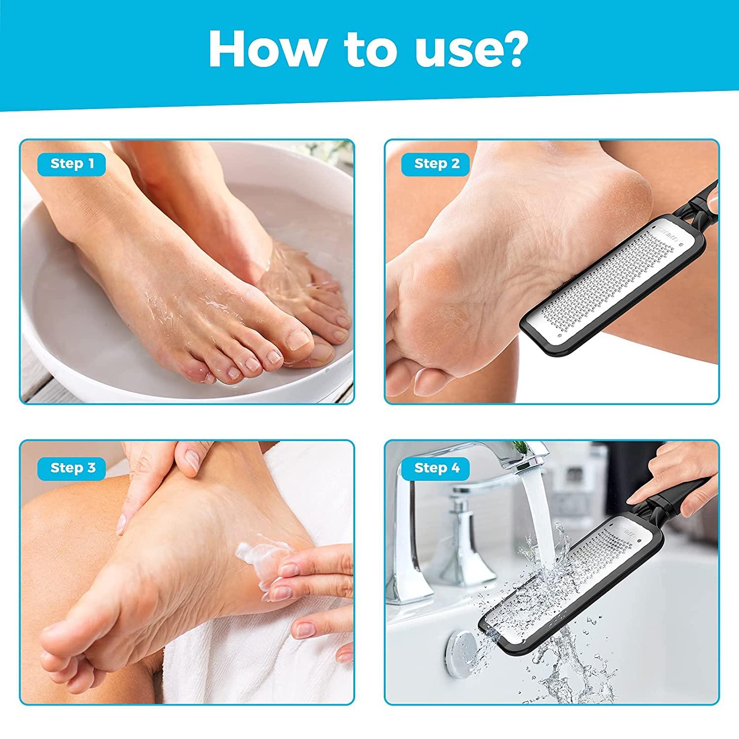 Callus Reducer File Files Calluses & Tough Skin Quickly and Easily
