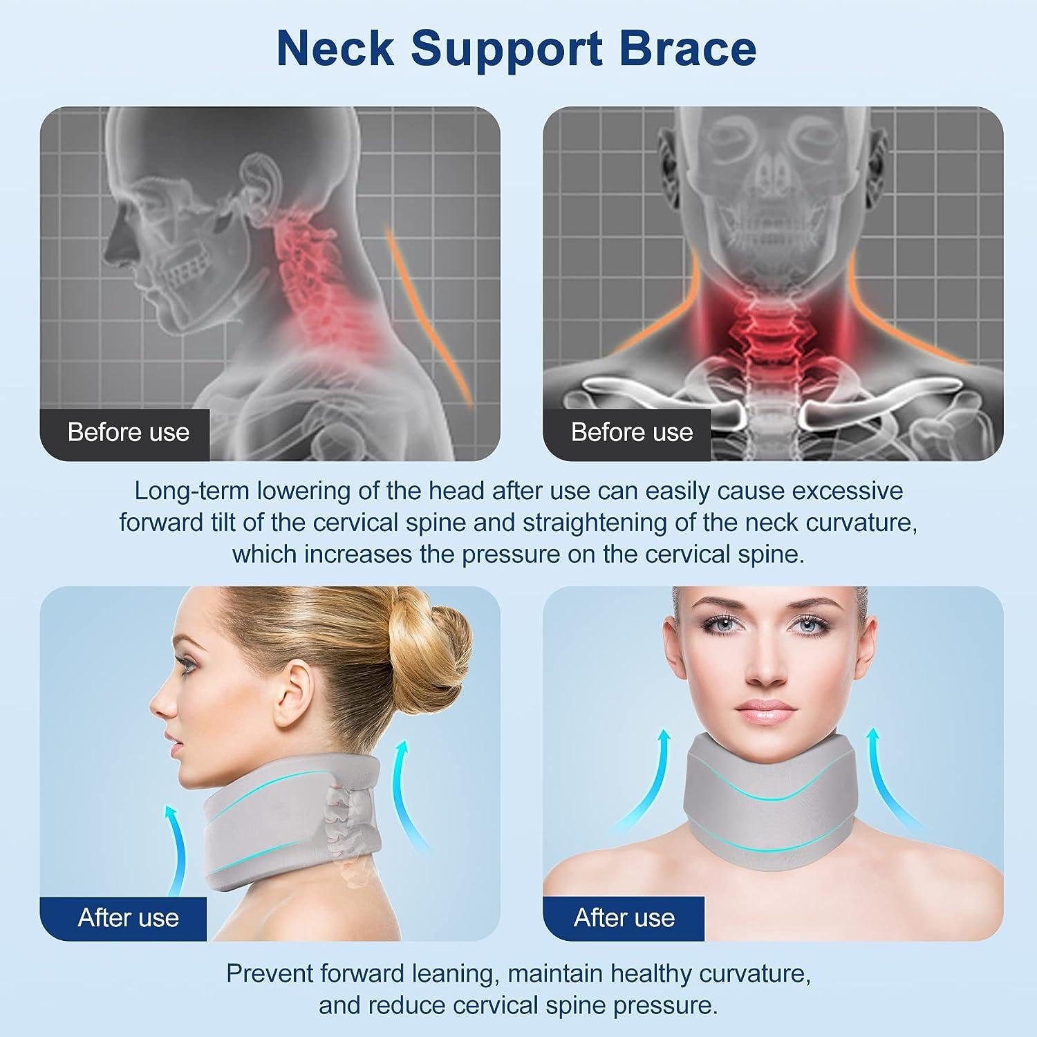 Neck braces to stabilise the cervical spine