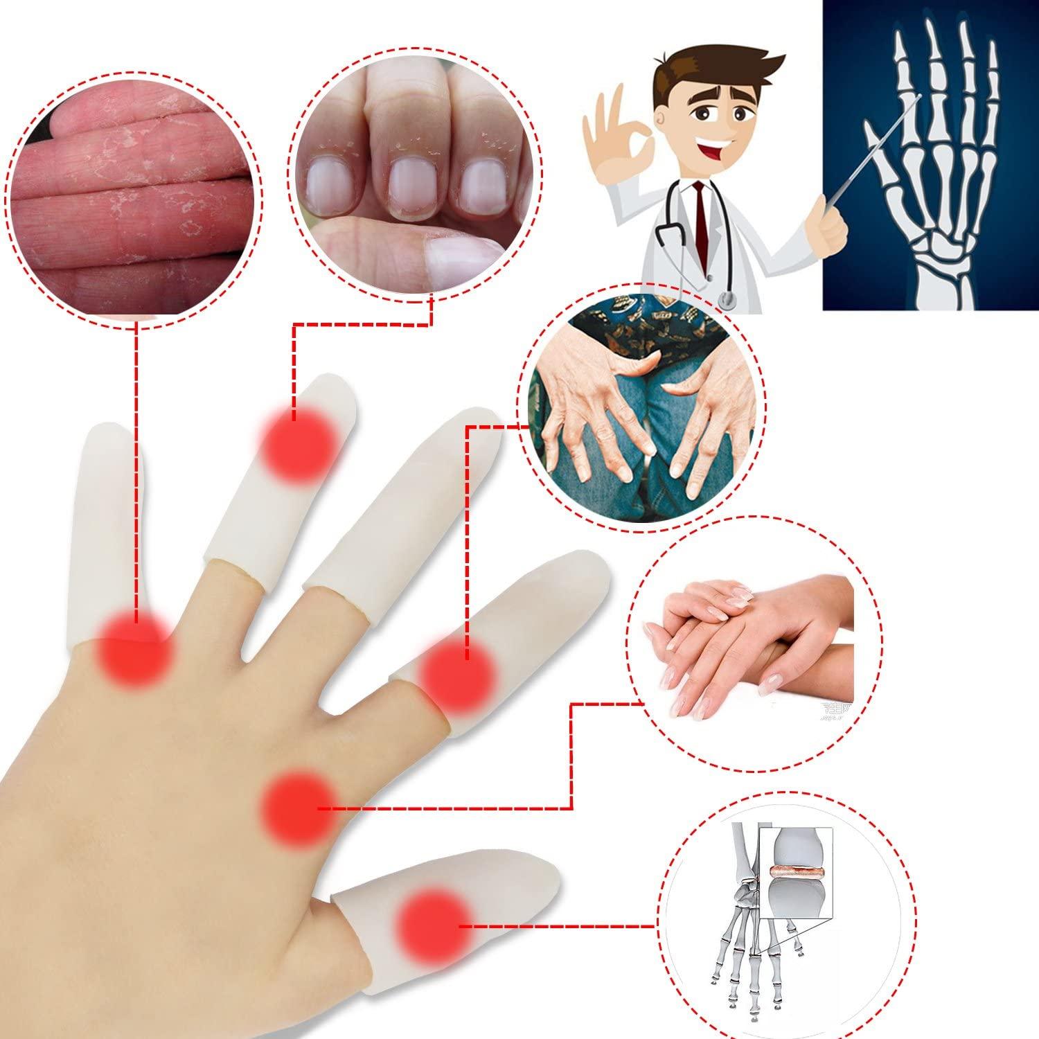 Gel Finger Cots, Finger Protector Support(14 PCS) New Material Finger  Sleeves Great for Trigger Finger, Hand Eczema, Finger Cracking, Finger  Arthritis and More. (Small Size) (White, Small)