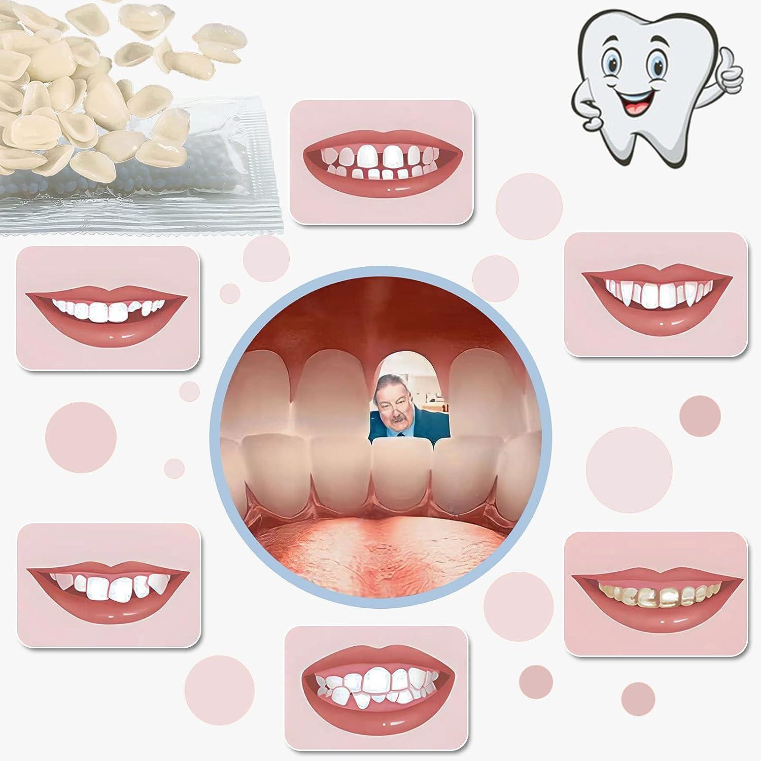 Moldable False Teeth Tooth Repair Granules, Teeth Repair Kit, Diy Temporary  Tooth Repair Beads Broken Tooth Repair