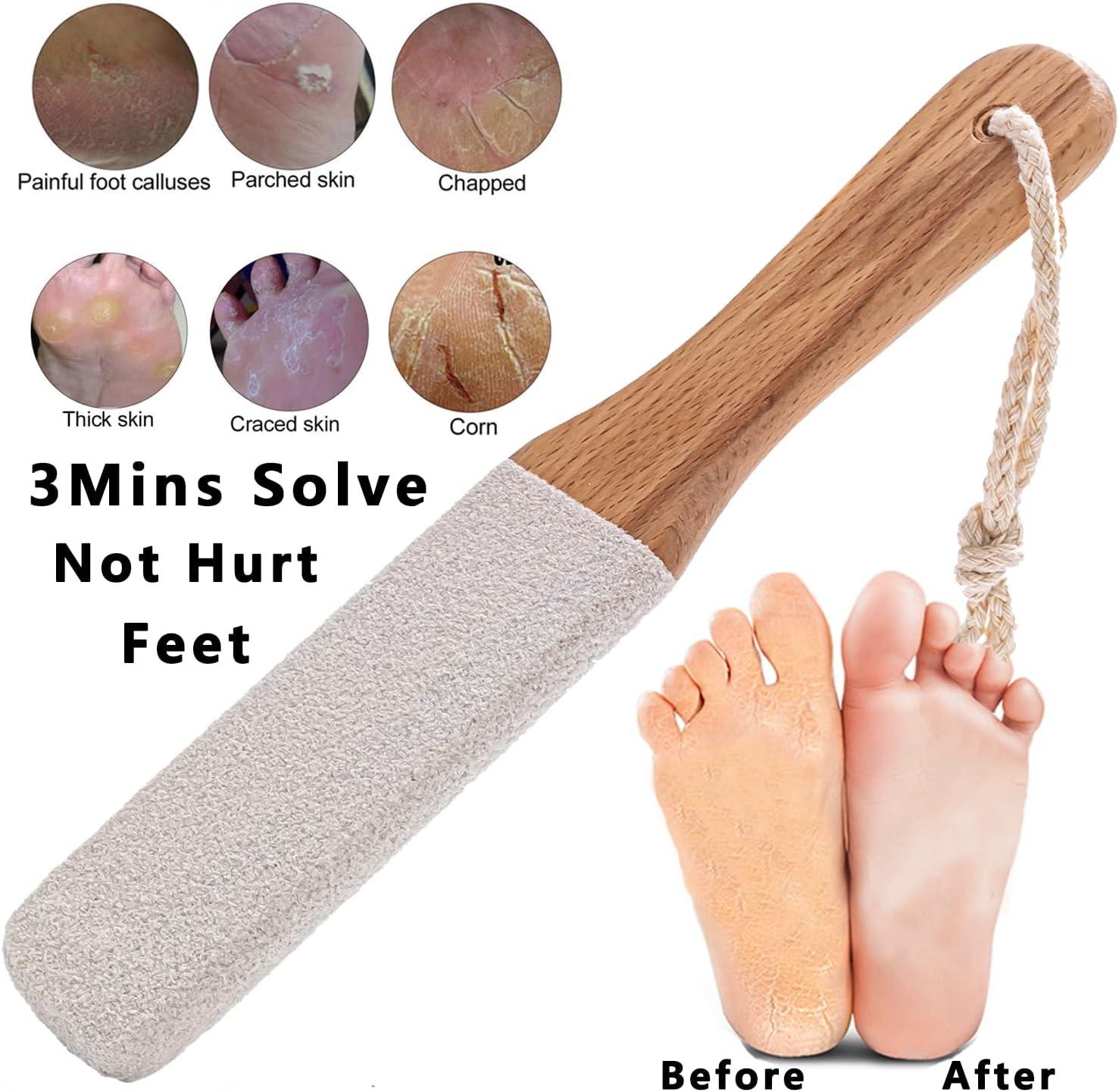 Hard skin callus remover foot scrub - Foot dead skin remover