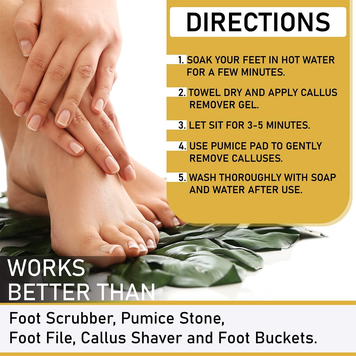  Excuse Me Feet Callus Remover, Liquid Gel for Callus and Corn  Remove Dead and Cracked Skin on Feet and Heels. Works Better Than Electric  Shaver & Foot Scrubber (8 Ounce) 