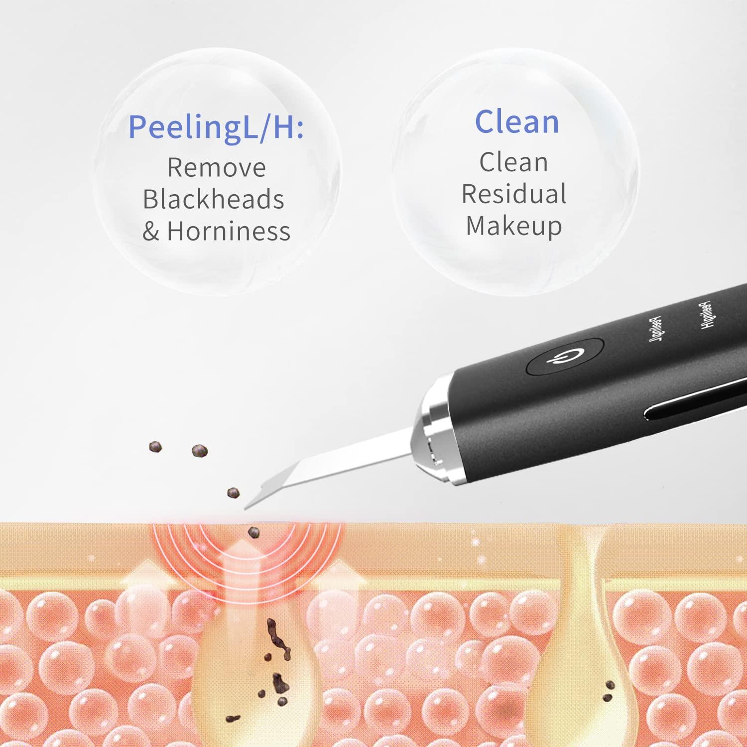 Best Ultrasonic Skin Scrubbers 2022 Beauty Editor Review Skin Scrubber Face Skin Spatula