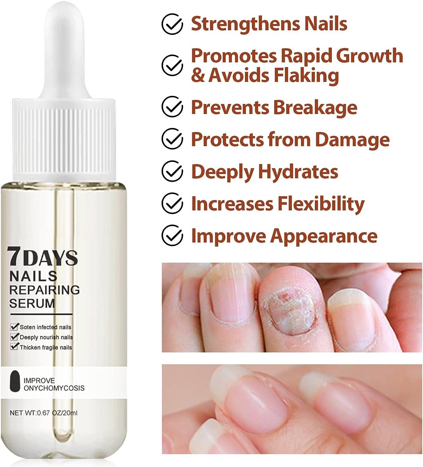 10FREE Polish+Nail Growth Serum STRONGER NAILS IN 7 DAYS - PINK SAND  BEACHES, Long-Wear 15ml/.5floz - Fry's Food Stores