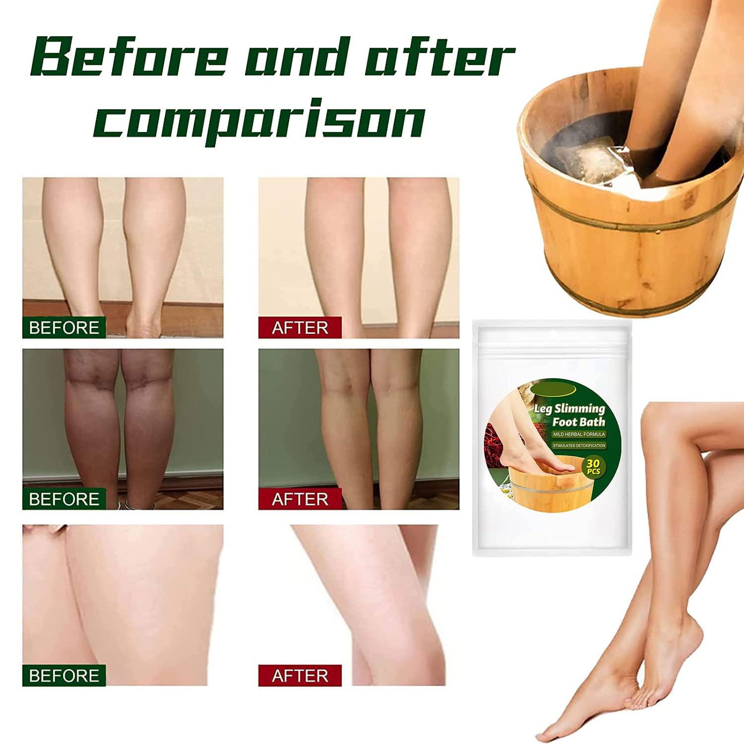 Footcare Products - Relieve Foot Pain & Leg Pain