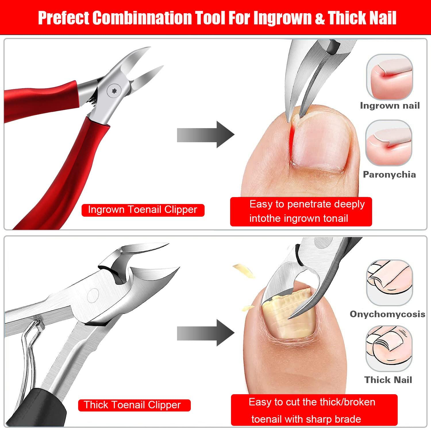 Toenail Clippers, Professional Thick & Ingrown Nail Clippers