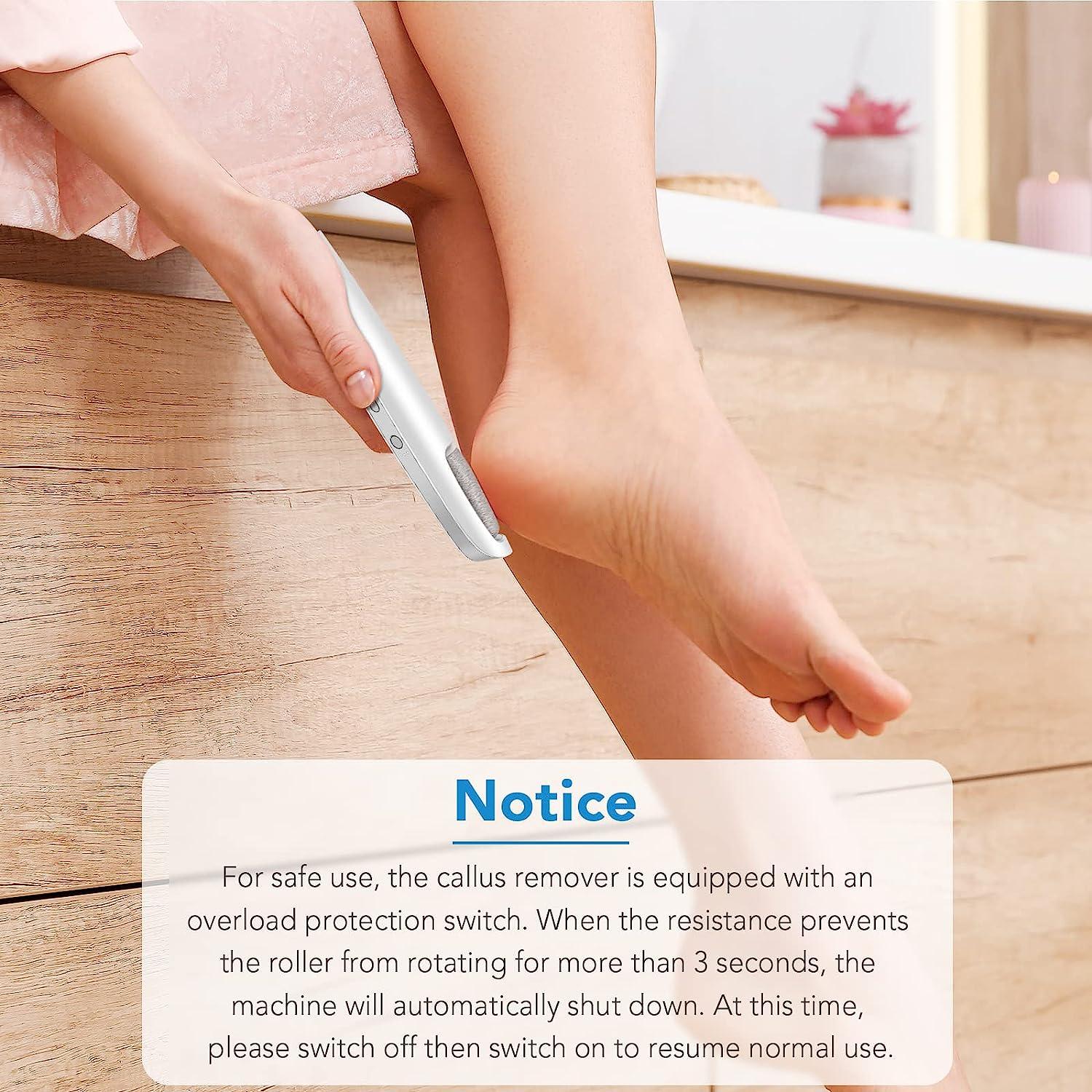 Smooth Pedicure Wand,Rechargeable Electric Callus Remover Tool for