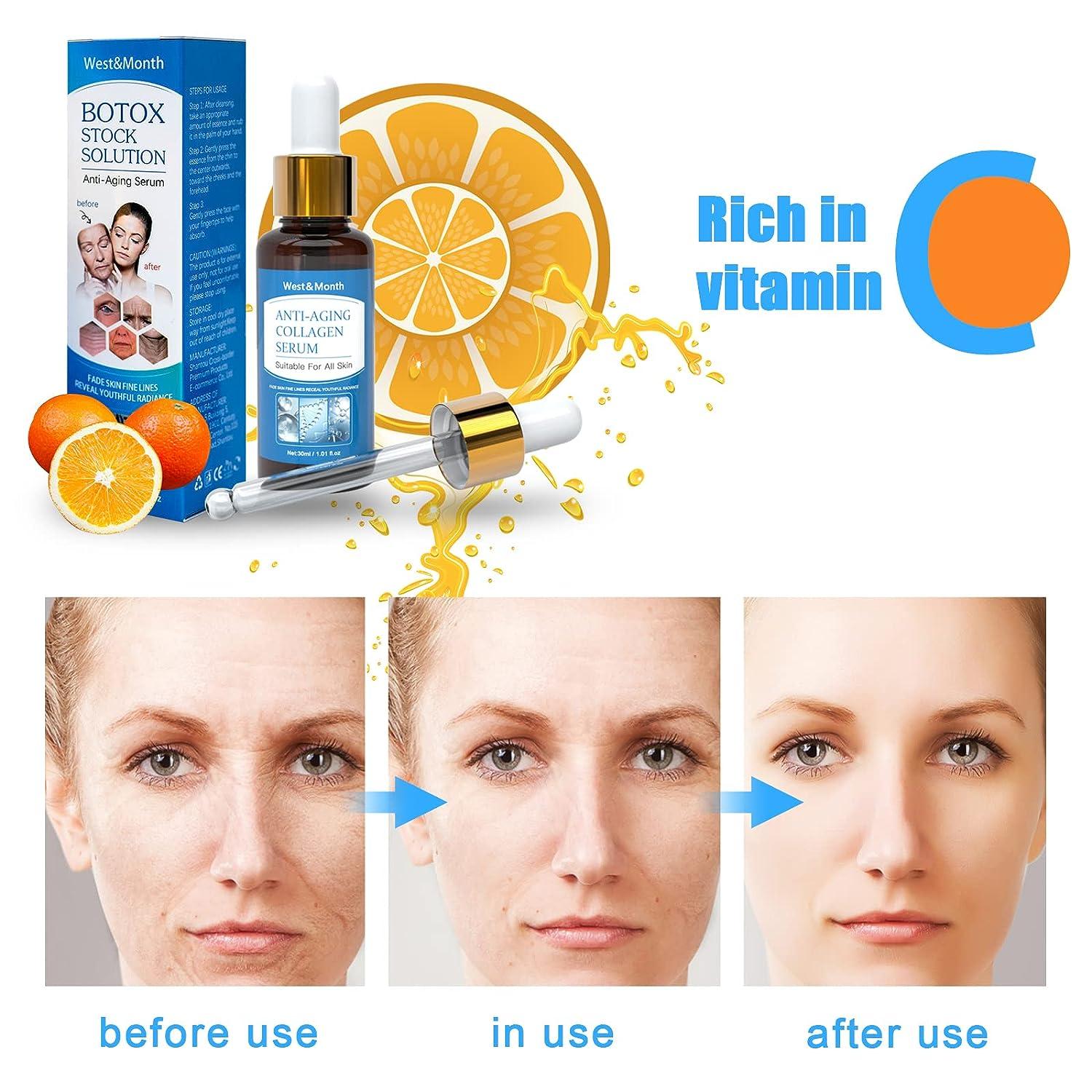 Botox Stock Solution Facial Serum Jennifer Aniston Vitamin C Serum For ...