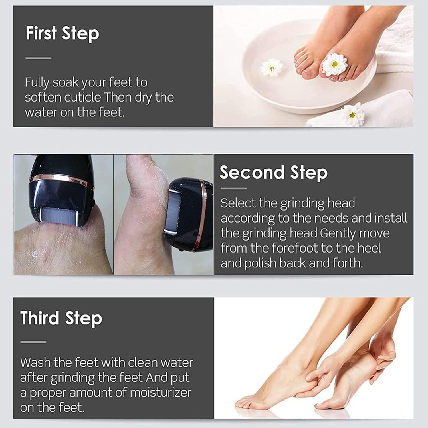 electric foot callus remover,portable electronic foot