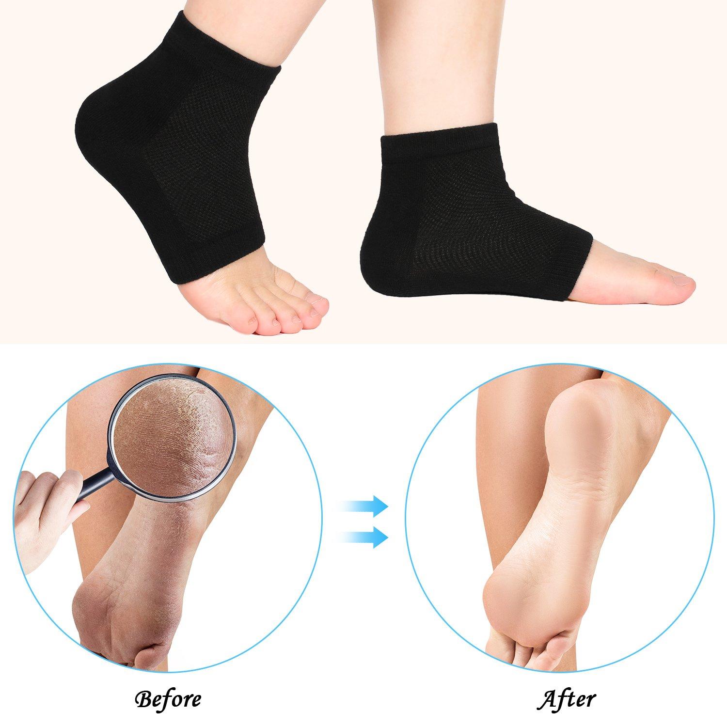 Moisturizing Silicone Gel Heel Socks for Dry Hard Cracked Skin