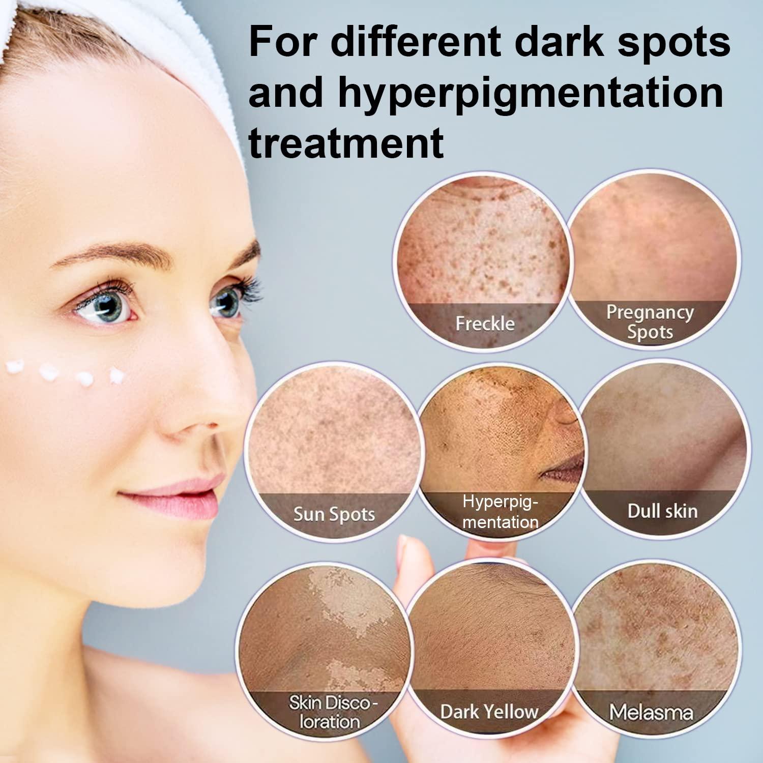 What S Good For Dark Spots In Face - Printable Templates Protal