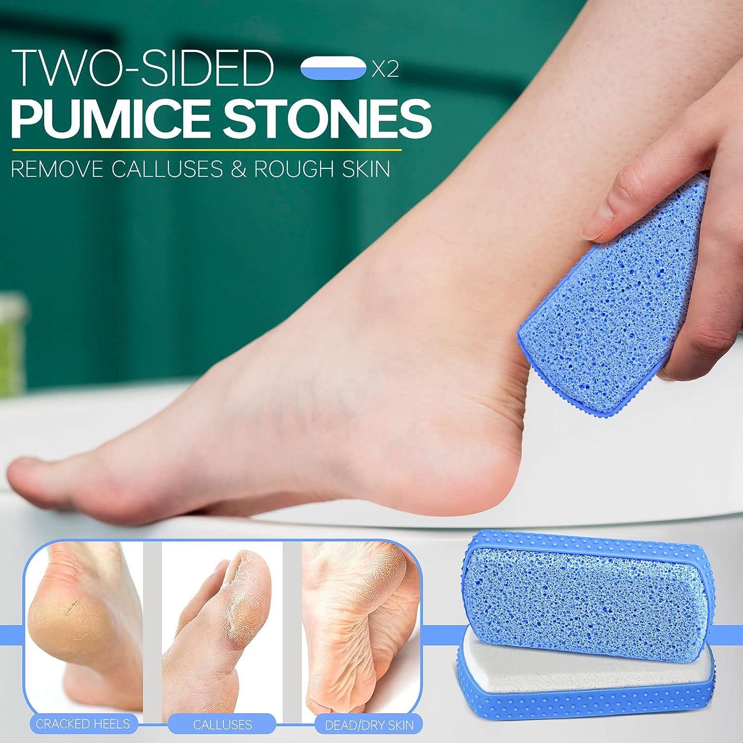 Pumice Stone for Feet Callus Remover Foot Scrubber Best Foot Care Pedicure  Tool to Exfoliate Hard Dry Skin 