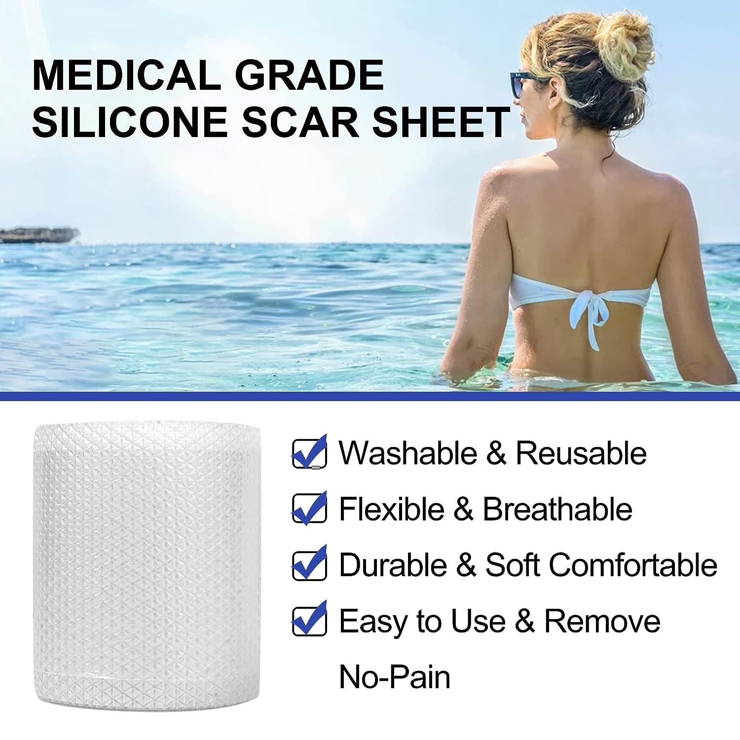 Clear Silicone Scar Sheets (1.6 x 120 ) Medical Grade Soft Silicone Scar  Tape Roll Reusable Scar Silicone Strips Professional Scar Removal Sheets  for C-Section Surgery Burn Keloid Acne et