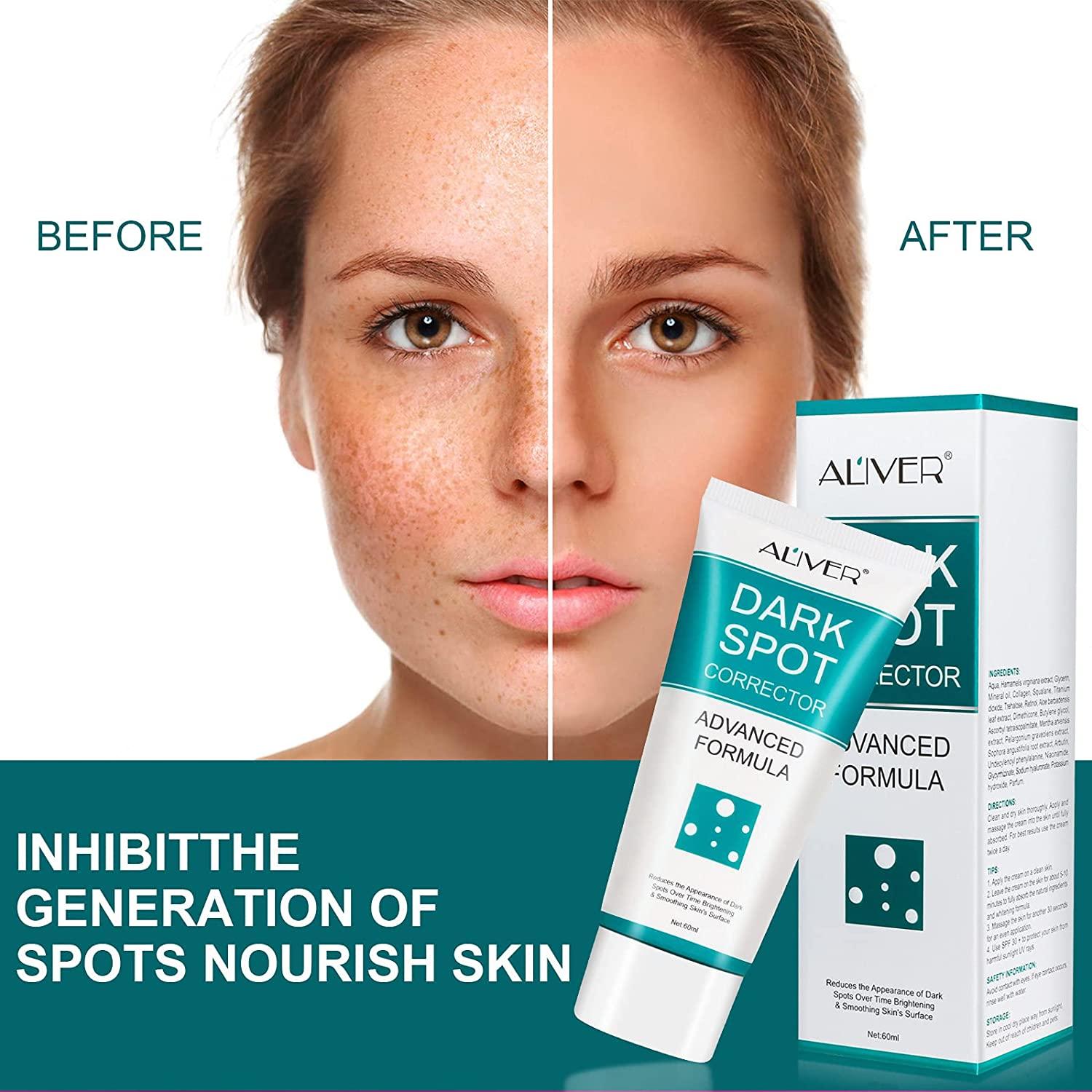 Dark Spot Corrector Dark Spot Remover For Face Fade Out The Skin