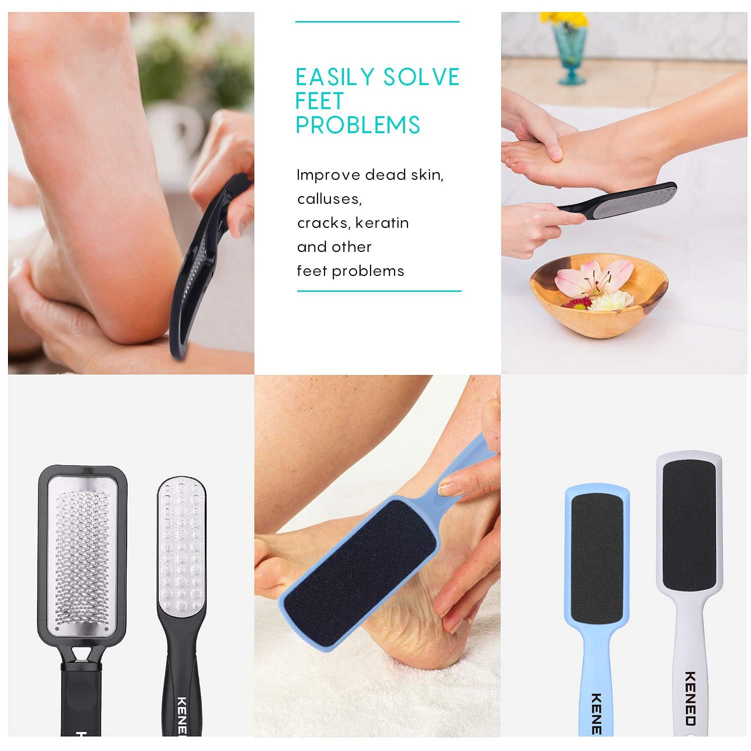 Feet Scrubber Dead Skin 5 Pack - KENED Foot File Callus Remover for Feet  Professional Pedicure Kit with 2 x Metal Foot Grater 3 x White Double-Sided  Pedicure Tools for Feet Care Black+white