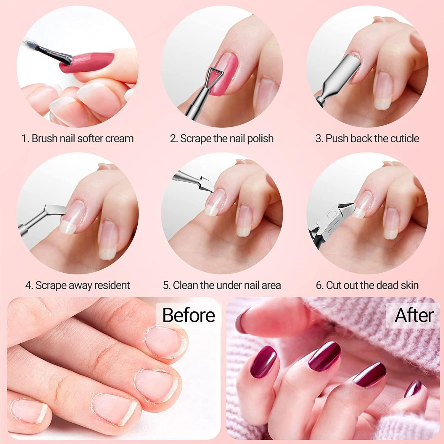 A, B, and C. Nail clipping technique with the use of nipper in order to