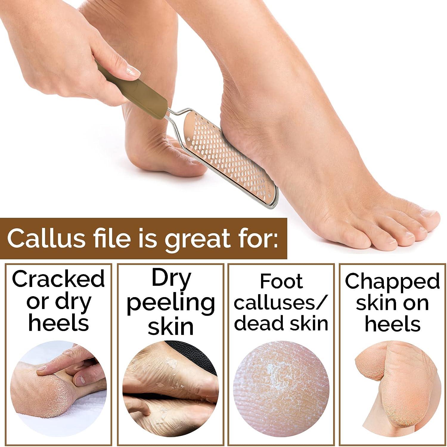 2 Pieces Foot File Callus Remover Heel Grater Wooden Handle Foot Scrubber  Pedicure File Foot Filer for Dead Skin Professional