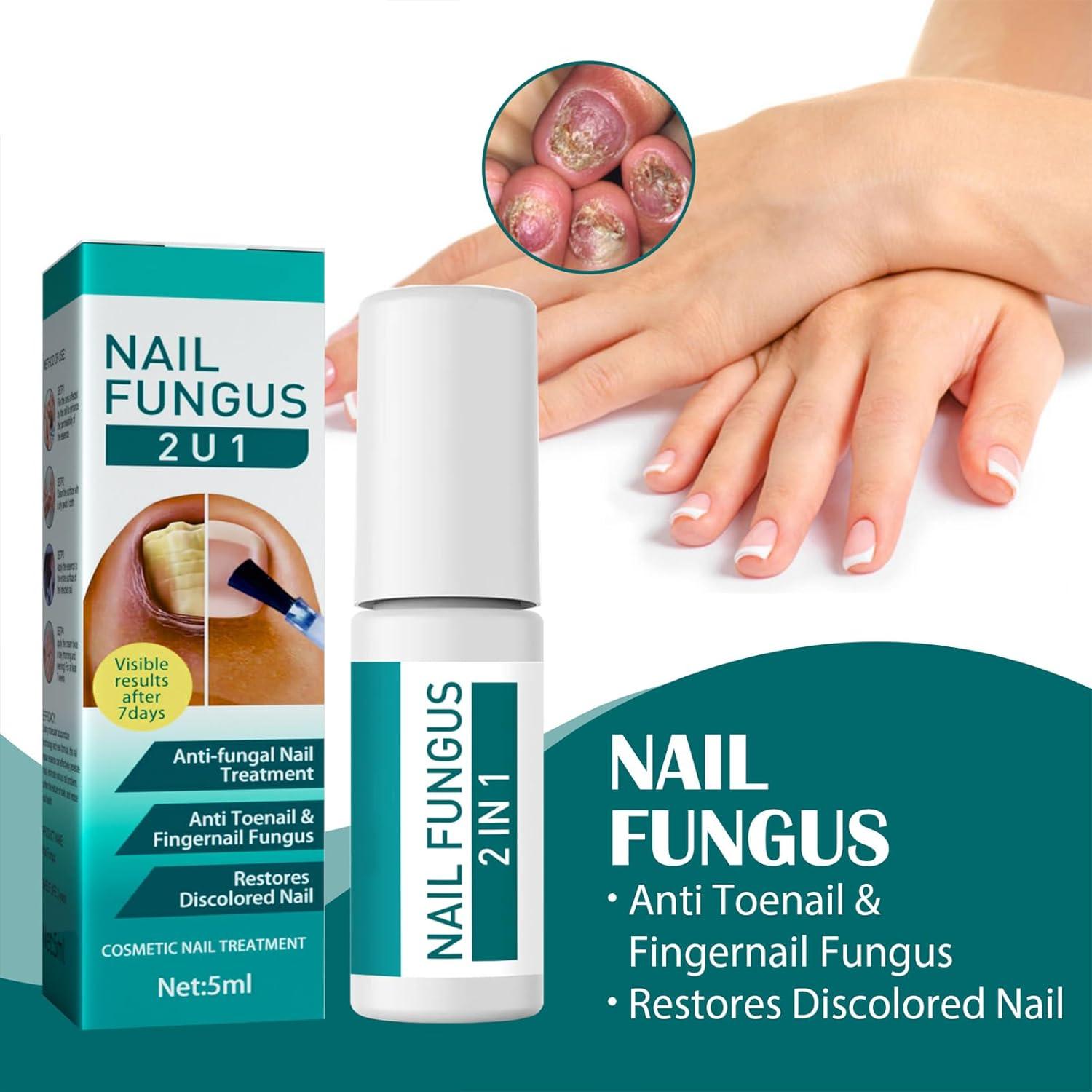 Tea tree oil for nail fungus: Effectiveness, side effects, and more