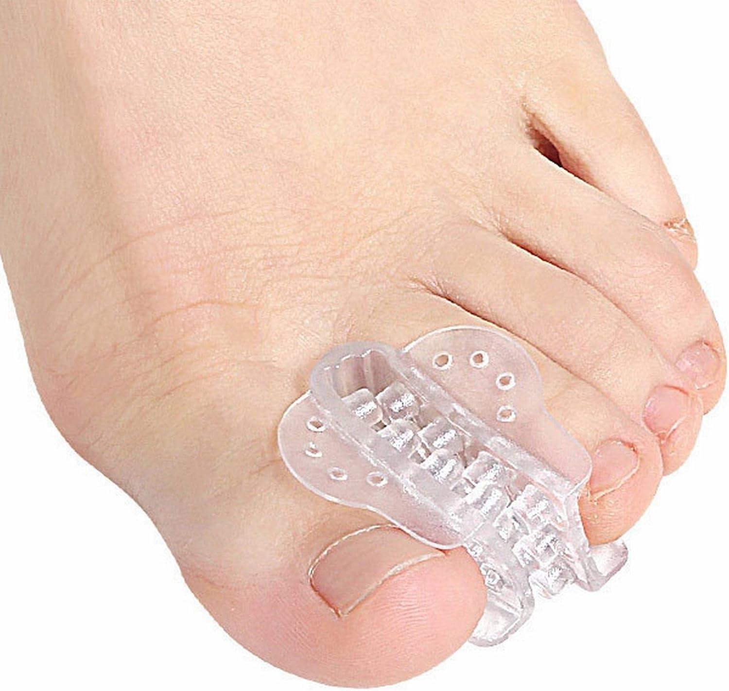 PEDIMEND™ 2X Gel Toe Separators and Toe Spacers for Hallux Valgus & Crooked  Toes