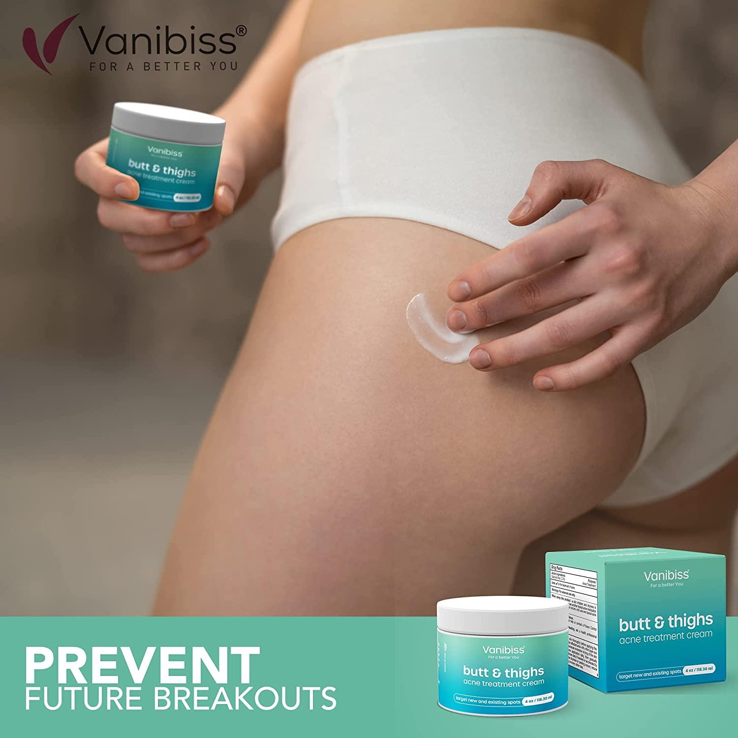 Vanibiss Butt & Thighs Acne Treatment Cream - Butt Acne Clearing Cream for  Pimples, Zits, Razor Bumps, Dark Spots - Acne Clearing Lotion for Buttocks  & Body - Inner Thigh Blackhead Remover (4oz)