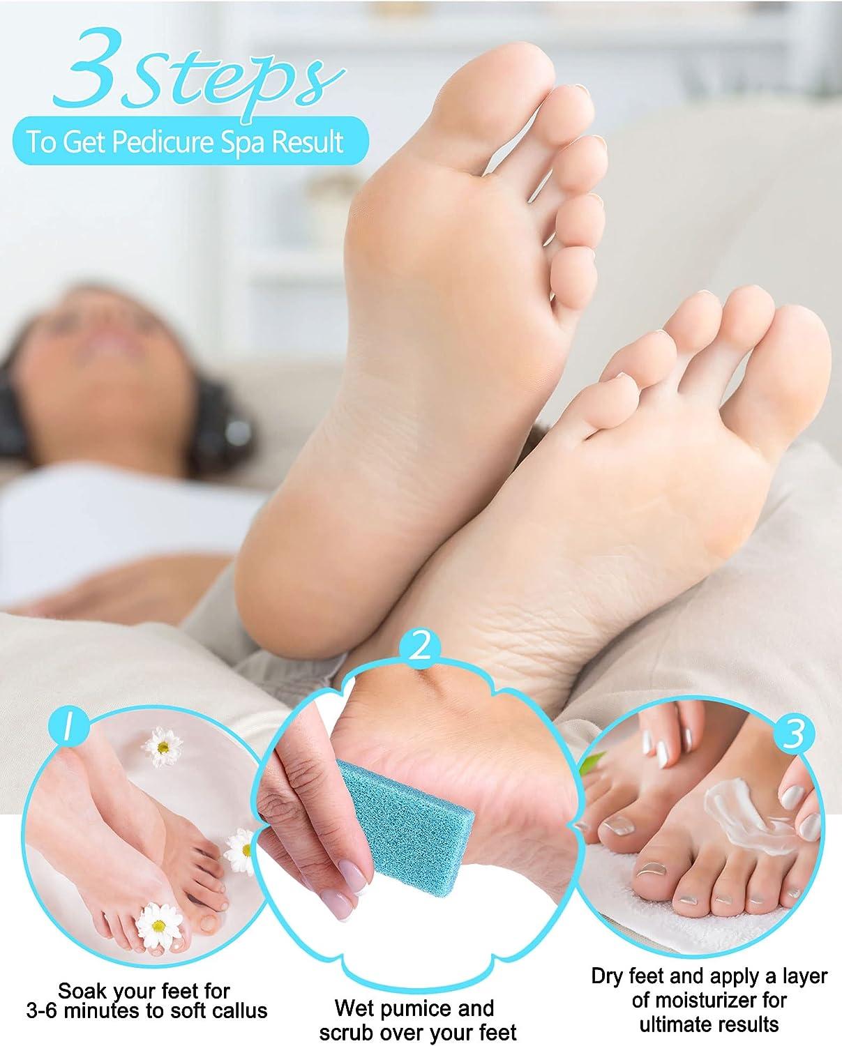 Pumice Stone for Feet Callus Remover Foot Scrubber Best Foot Care Pedicure  Tool to Exfoliate Hard Dry Skin 