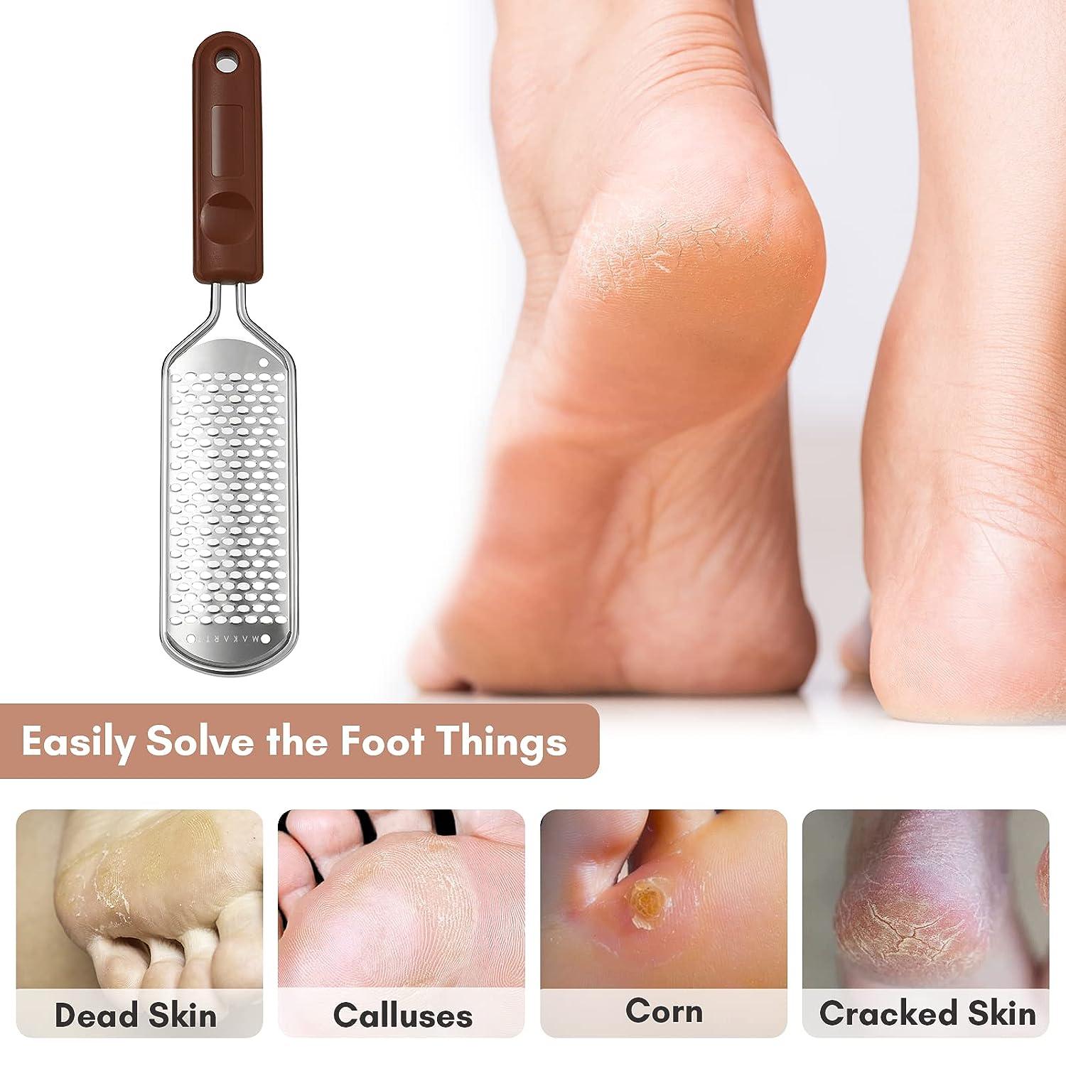 Foot File for Dead Skin, Callus Remover for Feet, Metal Foot Scrubber for  Cracked Heels, Professional