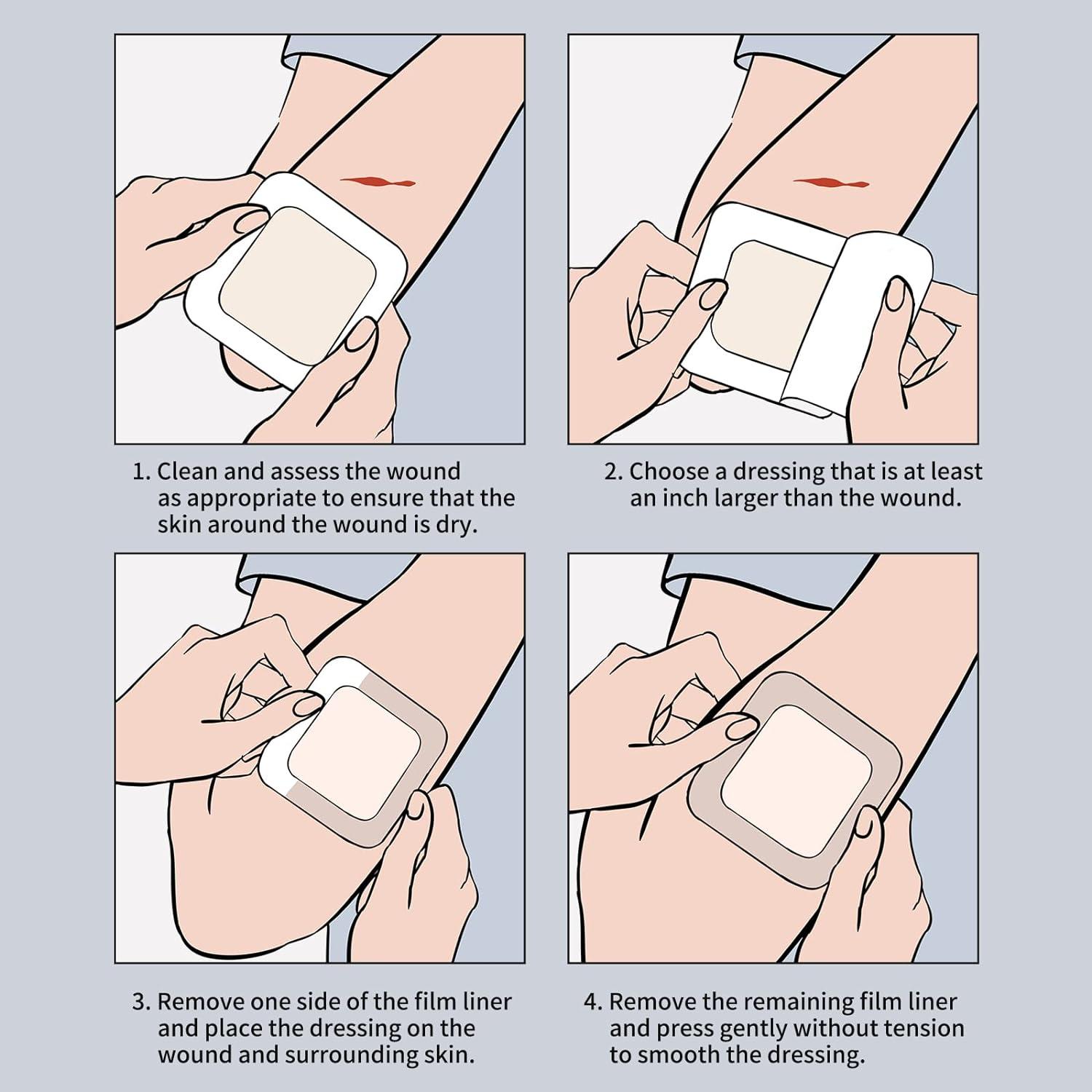 Wound Dressing Types - OSCE Guide | Geeky Medics