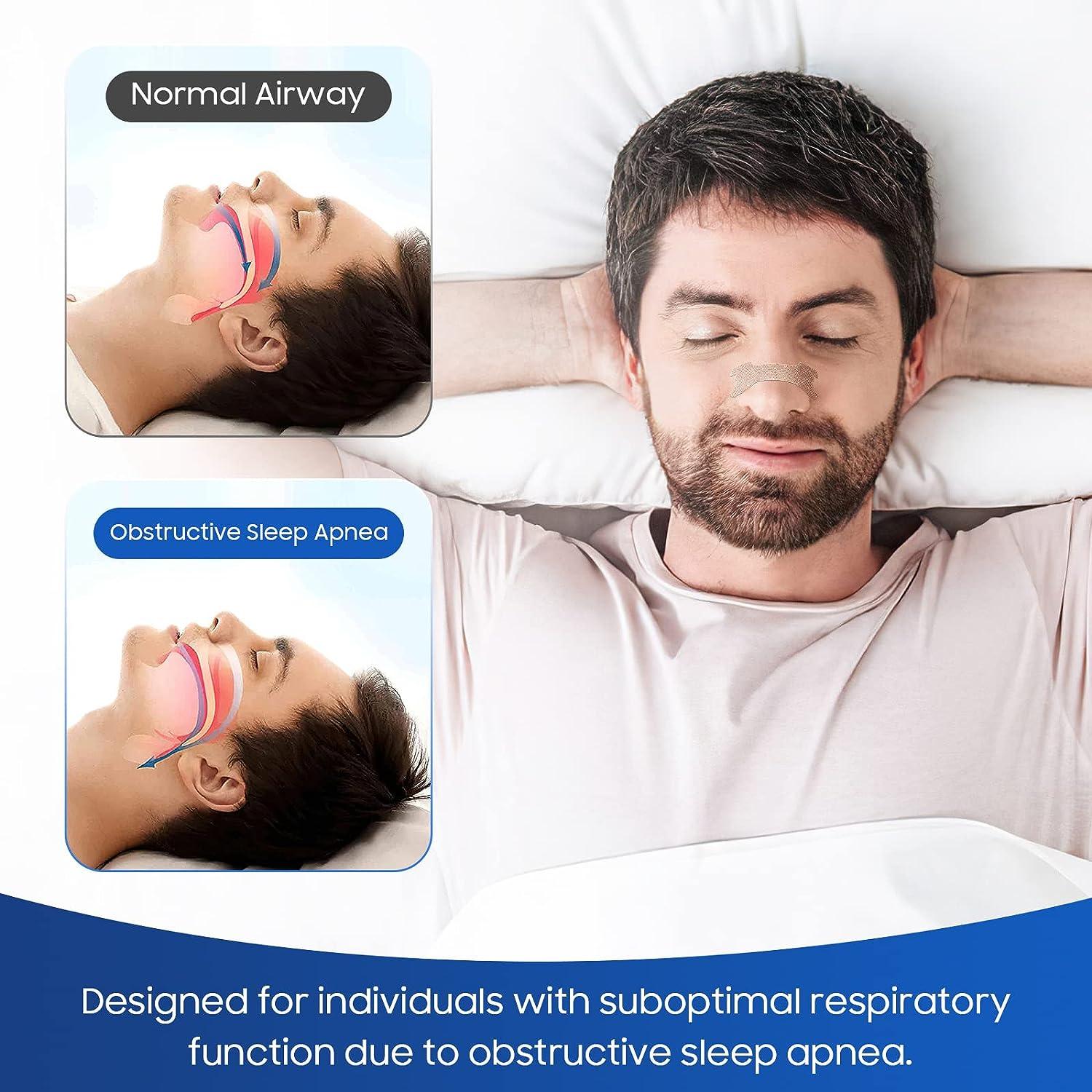 Can Nasal Strips Treat Sleep Apnea?
