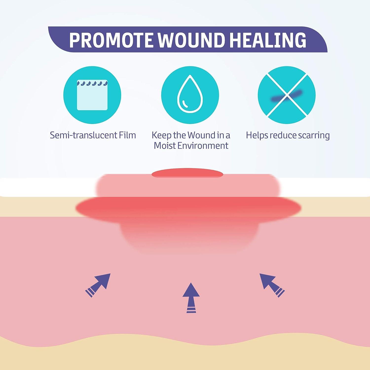 How to Choose the Best Medical Tape for Wound Care? - Conkote