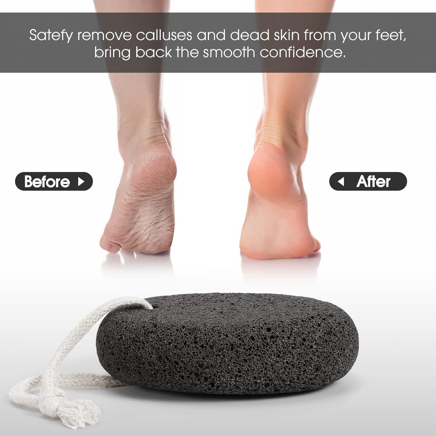  Karlash Professional Pedicure Foot Pumice Stone for