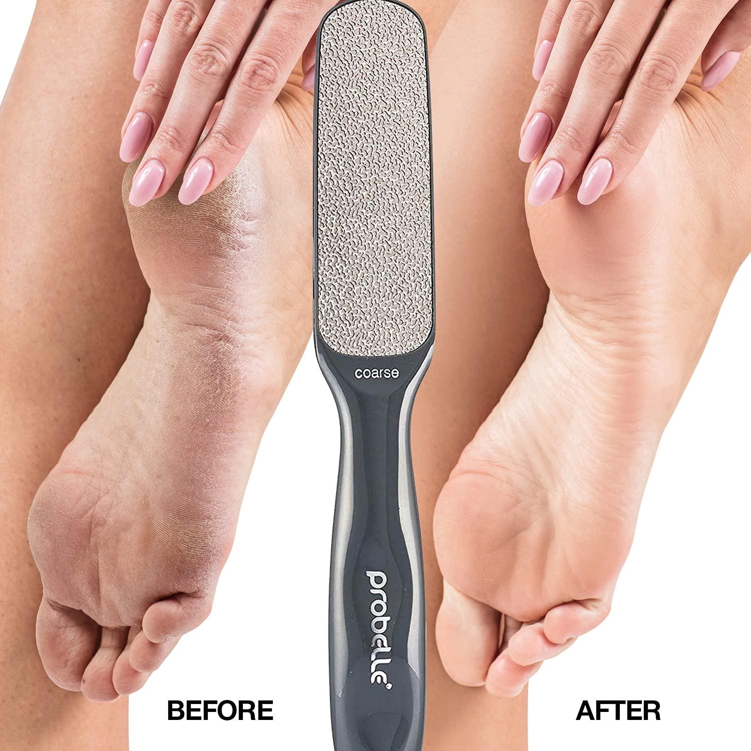 DUAL SIDED CALLUS REMOVER (BLACK)