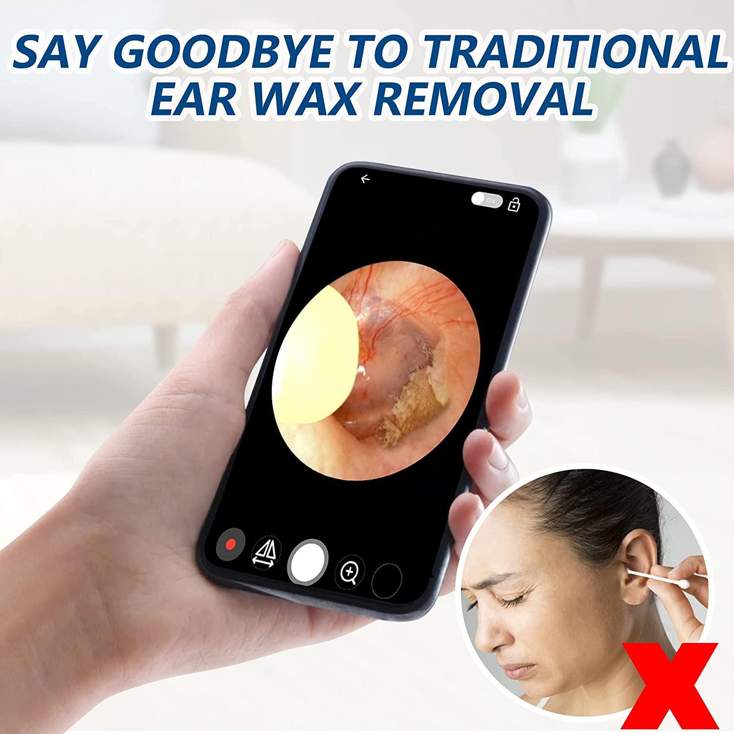 Ear Wax Removal Tool, Wireless WiFi Ear Cleaner with 1296P FHD Camera,  Earwax Remover, Ear Scope Otoscope with Light, Ear Cleaning Kit Smart  Visual for iPhone, iPad & Android