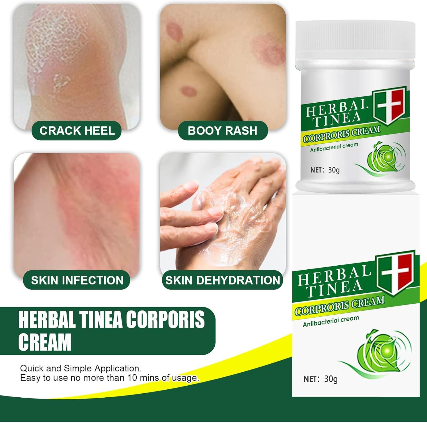 Tinea Corporis Treatment at best price in Bengaluru