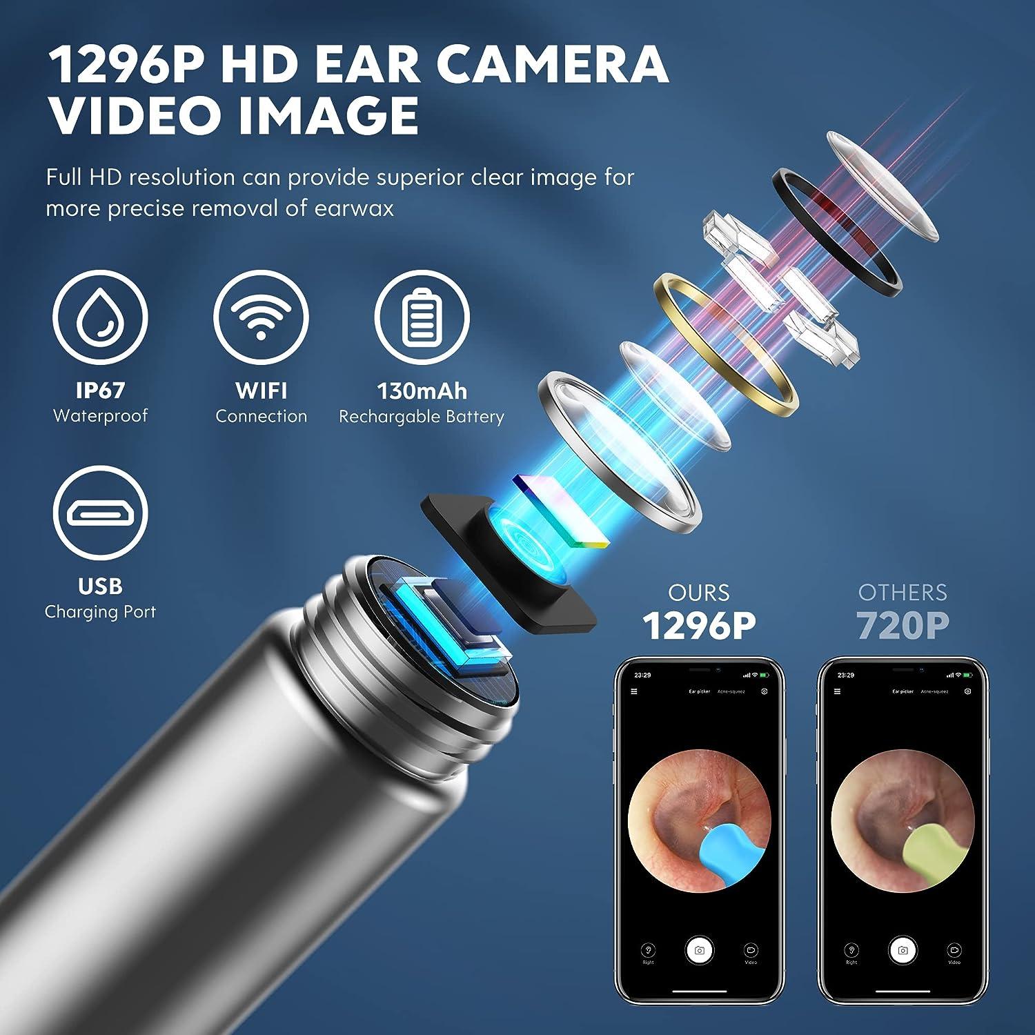 Ear Wax Removal - XLife Earwax Remover Tool with 1296P HD Camera and 6 LED  Lights Wireless Ear Cleaner with 7PCS Ear Set IP67 Waterproof Otoscope Ear  Wax Removal Kit for iPhone