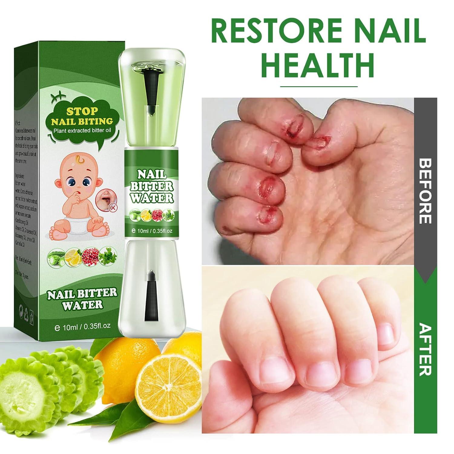 Nail Biting Treatment for Kids Natural Thumb Sucking Stop for-Kids  Bitter-Taste Plant Extract 0.35 Fl Oz (Pack of 1)