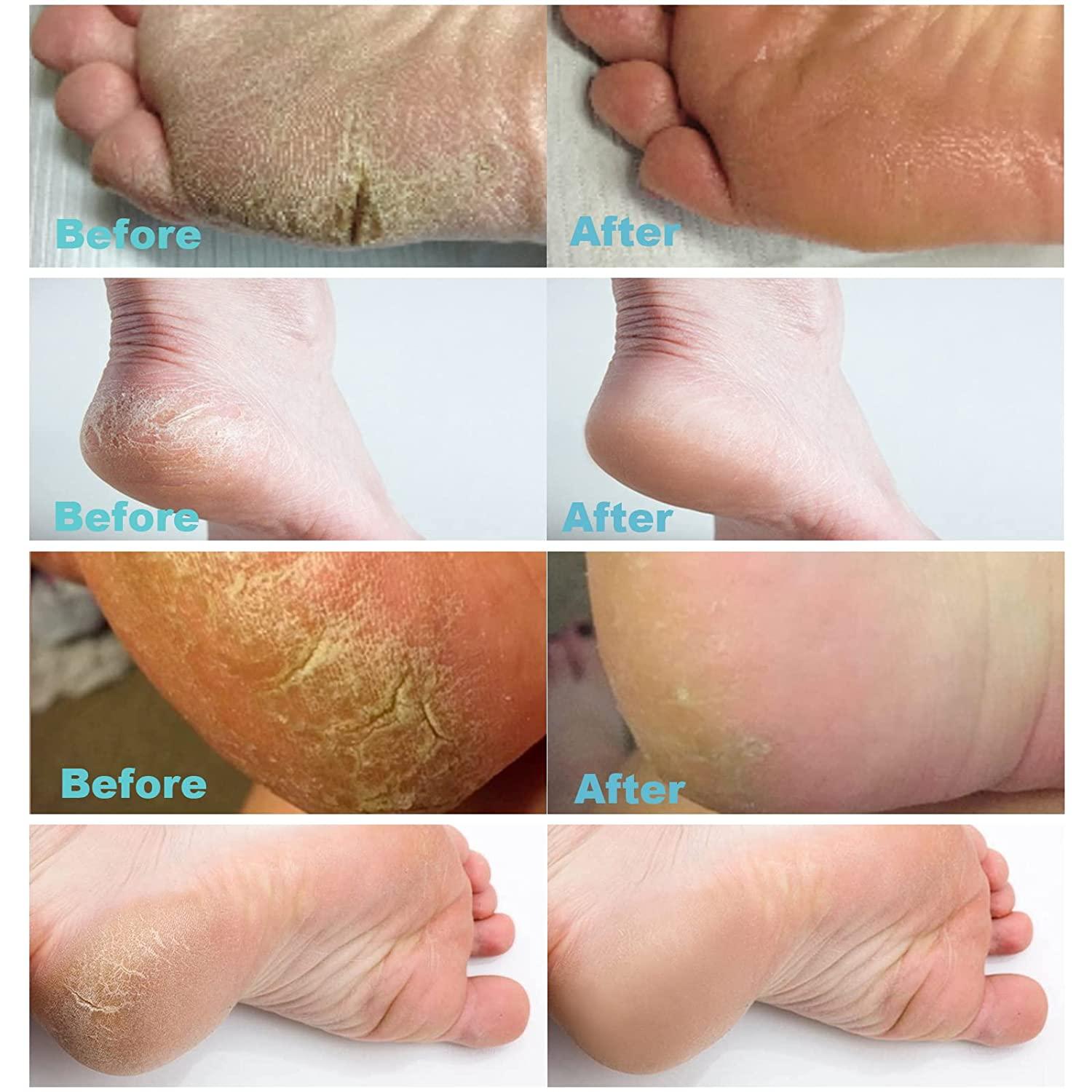 Nazakaa Foot Cream For Rough, Dry and Cracked Heel | Feet Cream For Heel  Repair |Healing & softening cream for Women & Men 100gm : Amazon.in: Health  & Personal Care