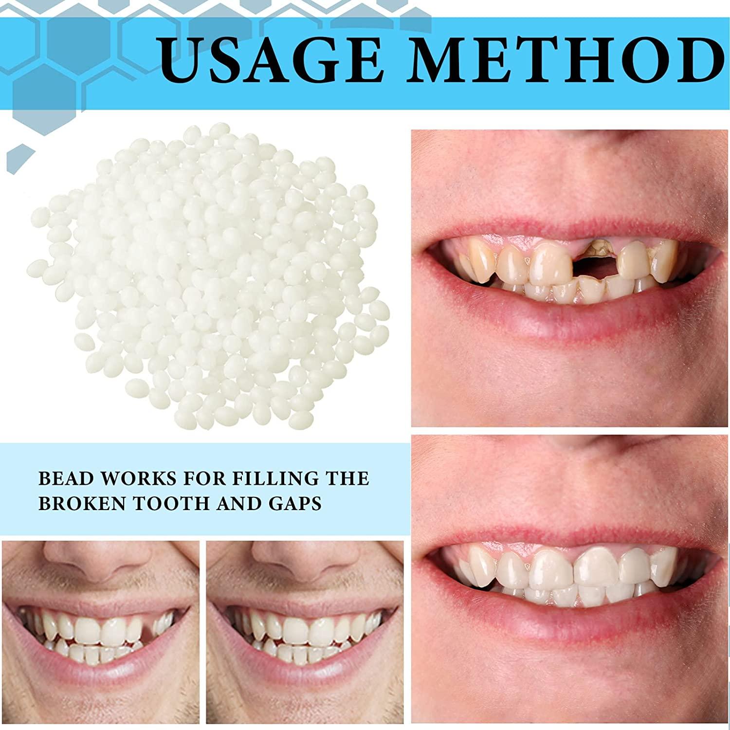 Fake Teeth for Missing Teeth Temporary Tooth Replacement Repair