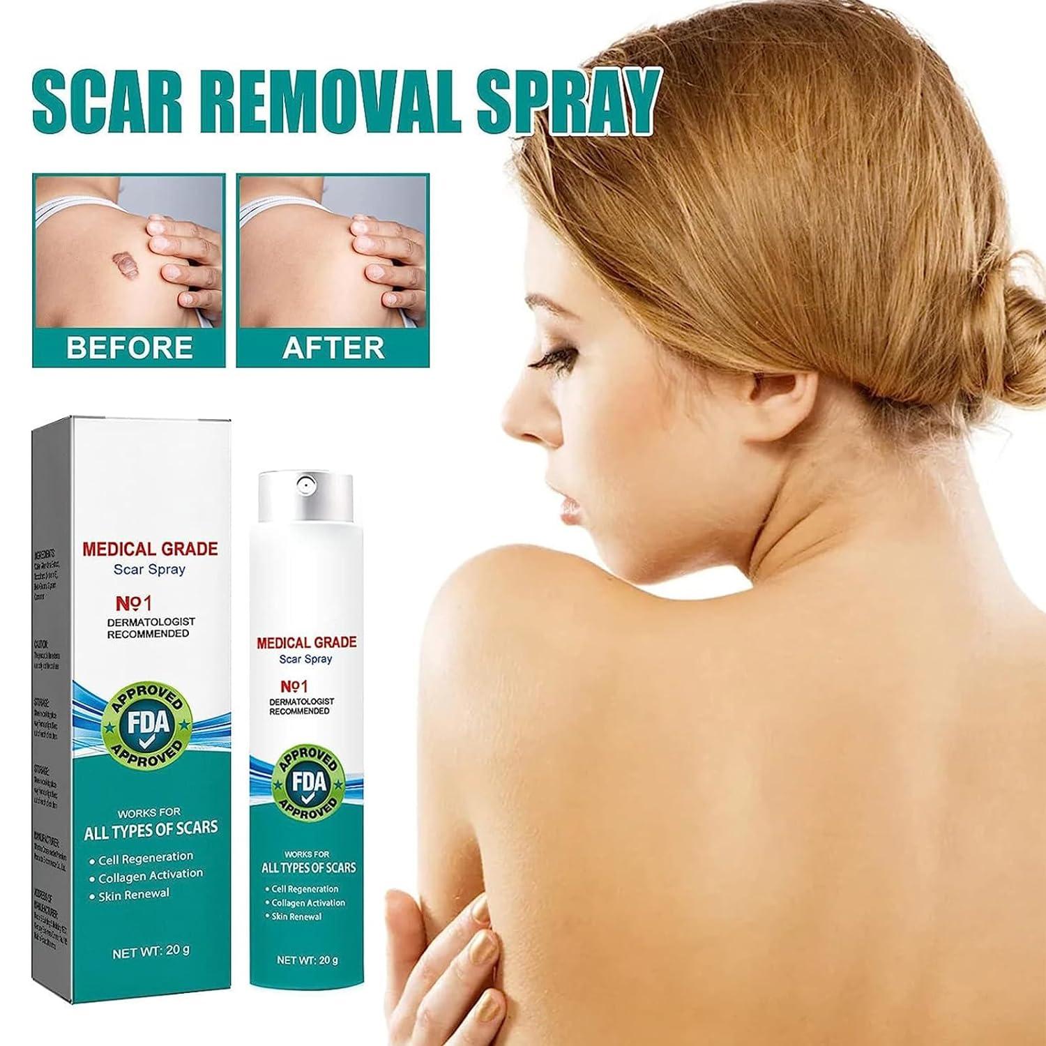 South Moon Medical Grade Scar Spray Scar Remove Advanced Scar For All Types Of Scars Acne Scars 4497