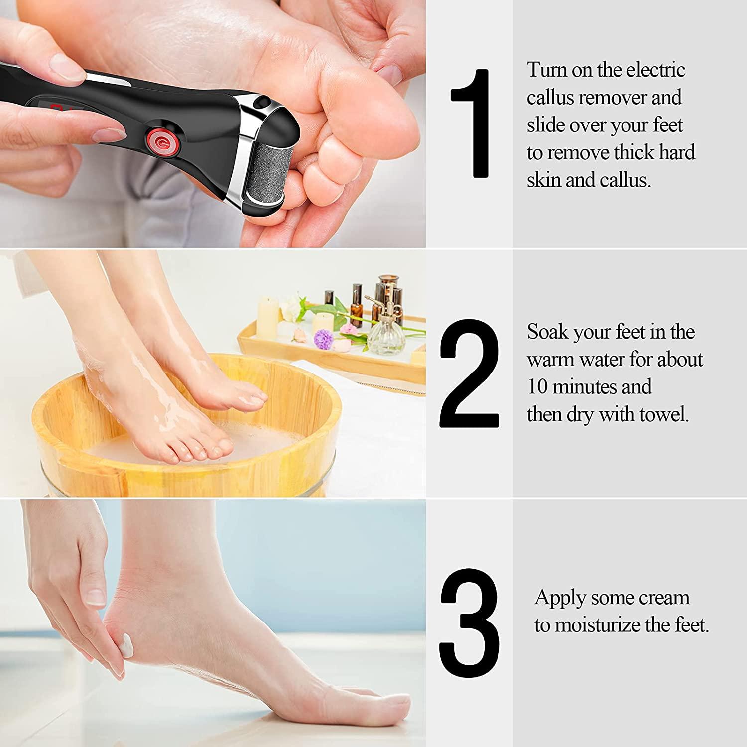 Foot File Electric Callus Remover for Feet - Cordless, 1 - Fry's Food Stores