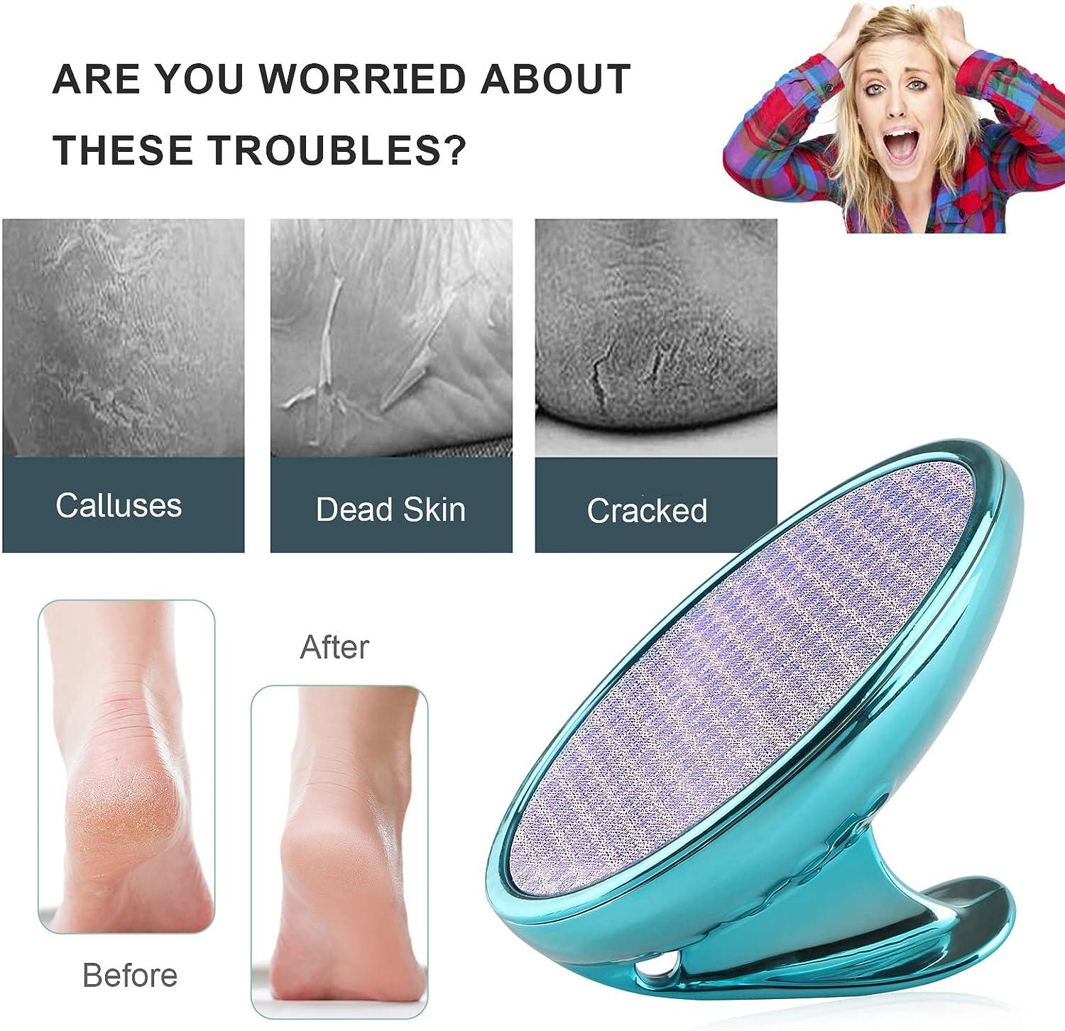 Upgraded Glass Foot File Callus Remover, Portable Handheld Feet