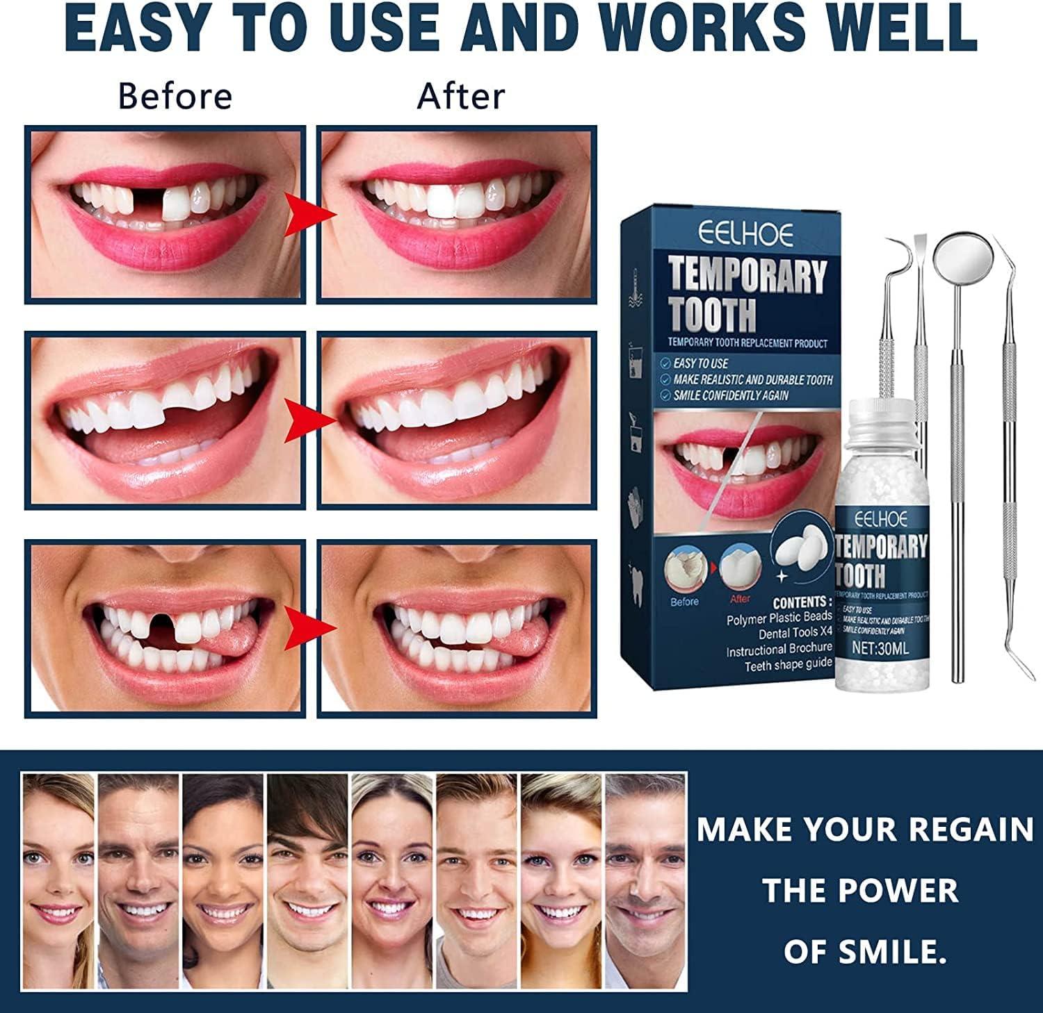 Teeth Repair Kit Temporary Teeth Replacement Kit Moldable False Tee
